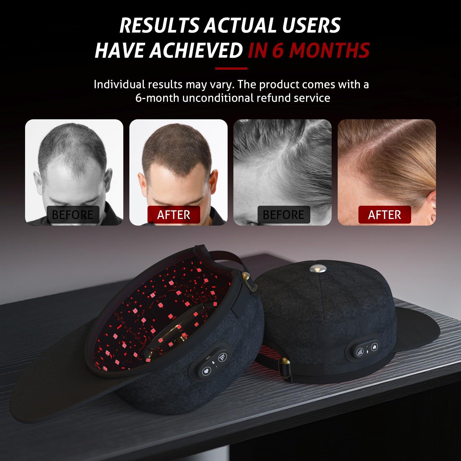Laser Cap, Laser Red Light Therapy for Hair Growth System, Hair Thinning & Alopecia Treatment for Men & Women, Laser Cap for Hair Regrowth Stimulates Denser Fuller Hair - Medaid International