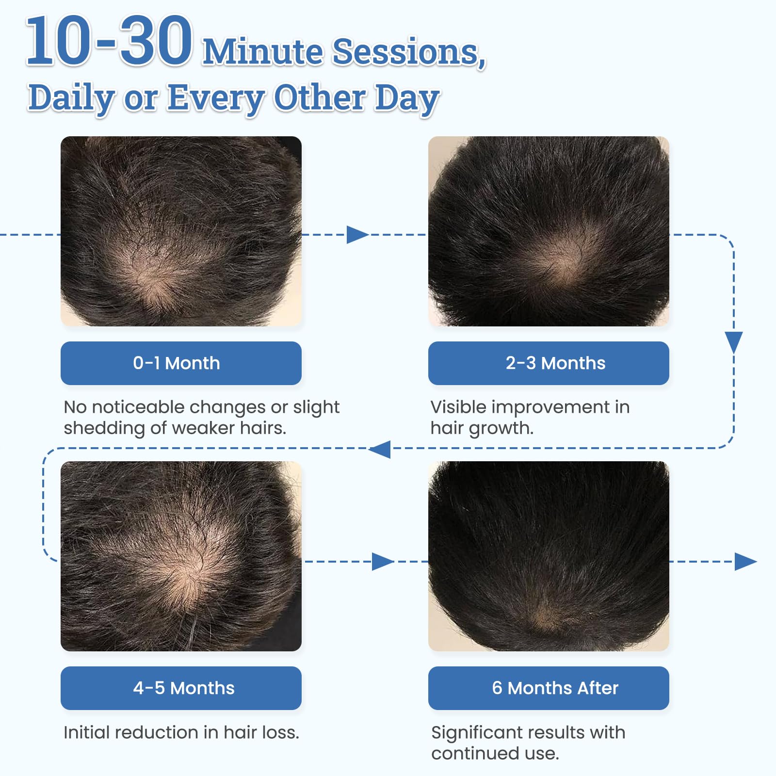 Laser Hair Growth Cap TW316 - Medaid International