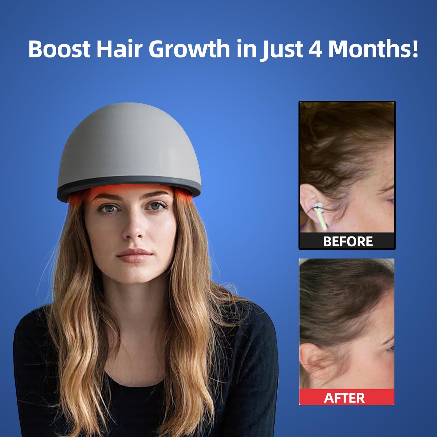 Laser Red Light Therapy for Hair Growth Device, FDA Cleared Hair Loss, Hair Growth Device - Medaid International