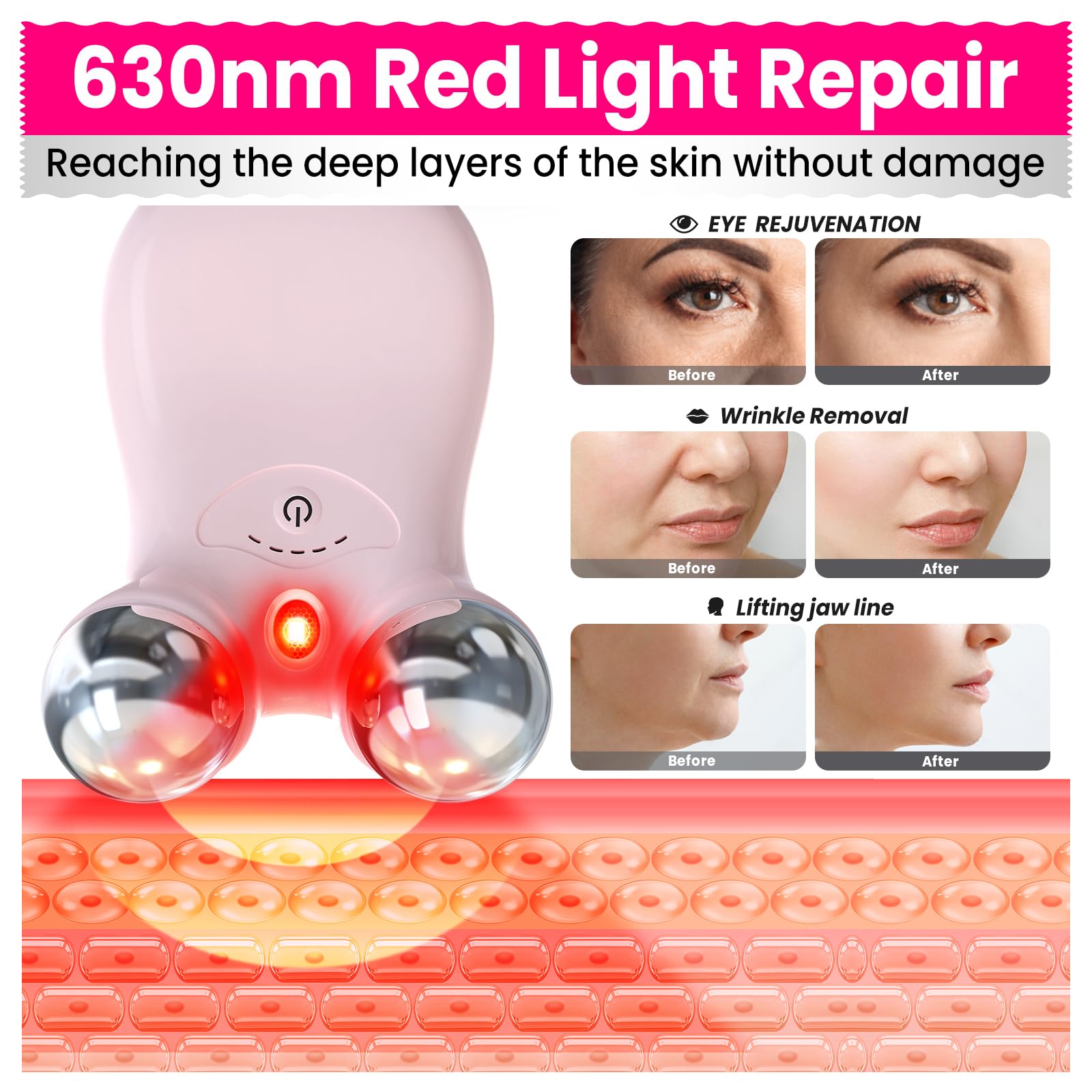 Hunvva Microcurrent Facial Device,Latest Red Light Technology,Enhances The Ability to Lift The Face and Tighten The Skin,Facial Wrinkle Equipment,Smart Photon Micro-Current Device,Model:EP-300. - Medaid International