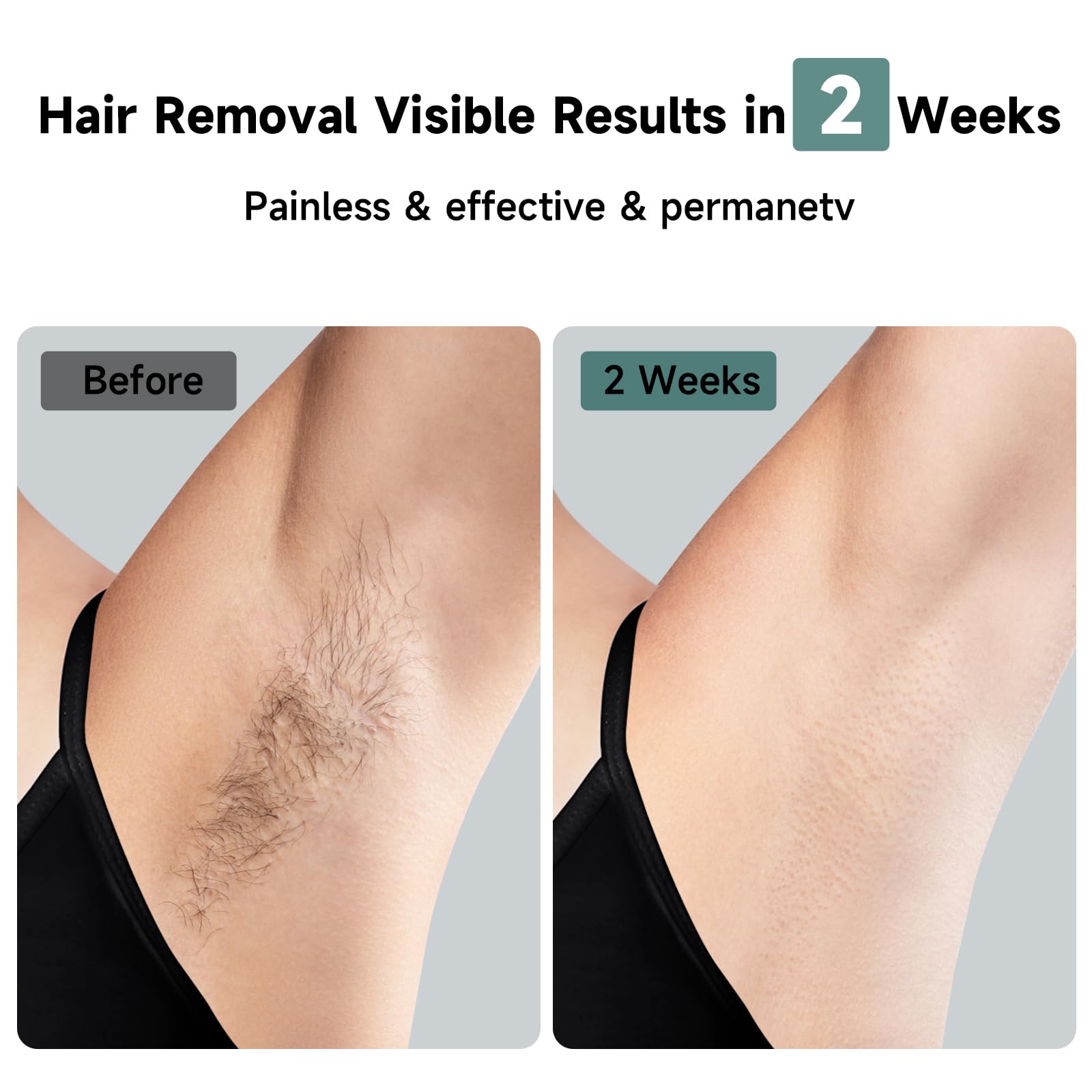 JOVS Laser Hair Removal, 37°F Painless Hair Removal Device with Sapphire Ice-Cooling, 3 in 1 Hair Removal & Skin Rejuvenation for Women and Men, 8 Modes Skin Care for Whole Body, Touch Screen - Medaid International