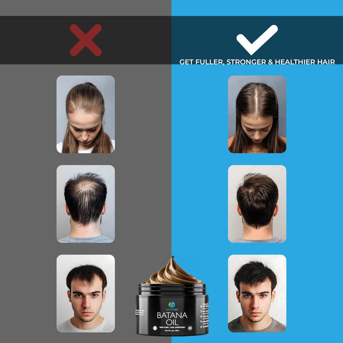 Premium Raw Batana Oil – Pure & Unrefined - Advanced Hair Regrowth & Scalp Therapy Device - Supports Fuller, Healthier Hair & Skin - For Men & Women, 2 OZ - Medaid International