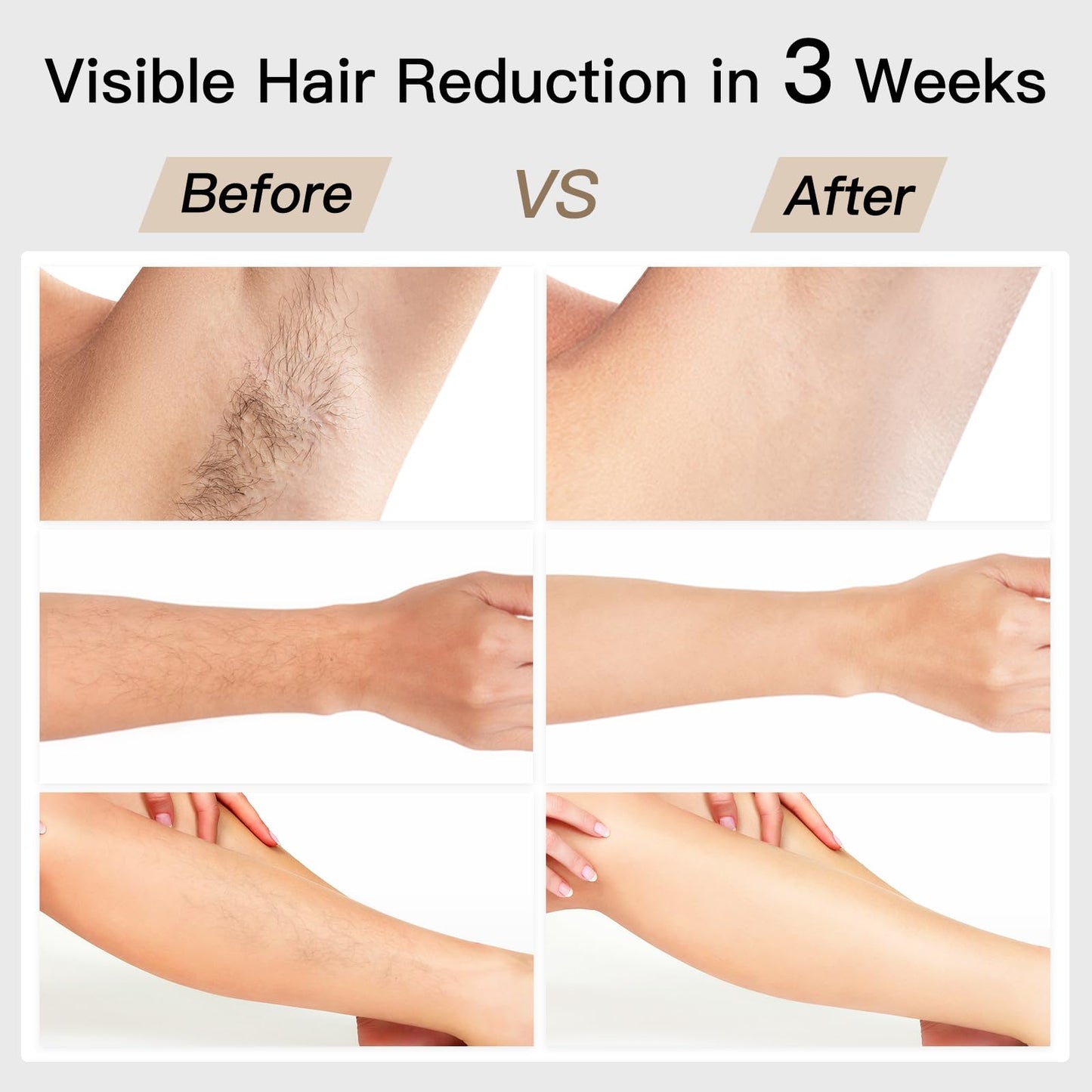 Laser Hair Removal, BoSidin IPL Hair Removal with Painless Ice-Cooling, 2-in-1 Face SR Rejuvenation, 6+1 Modes, 6 Levels Hair Removal for Women Permanent, Laser Hair Removal Kit with Shaver, Goggles - Medaid International