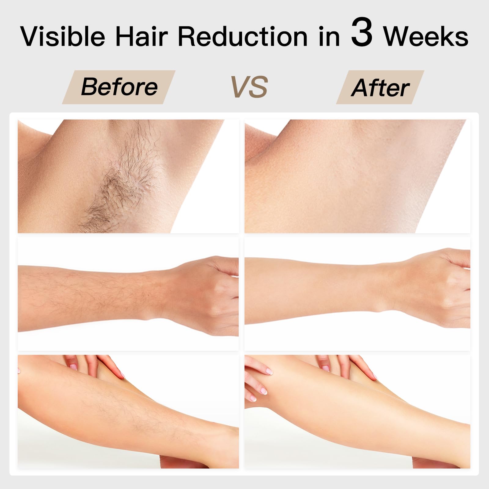 Laser Hair Removal, BoSidin IPL Hair Removal with Painless Ice-Cooling, 2-in-1 Face SR Rejuvenation, 6+1 Modes, 6 Levels Hair Removal for Women Permanent, Laser Hair Removal Kit with Shaver, Goggles - Medaid International