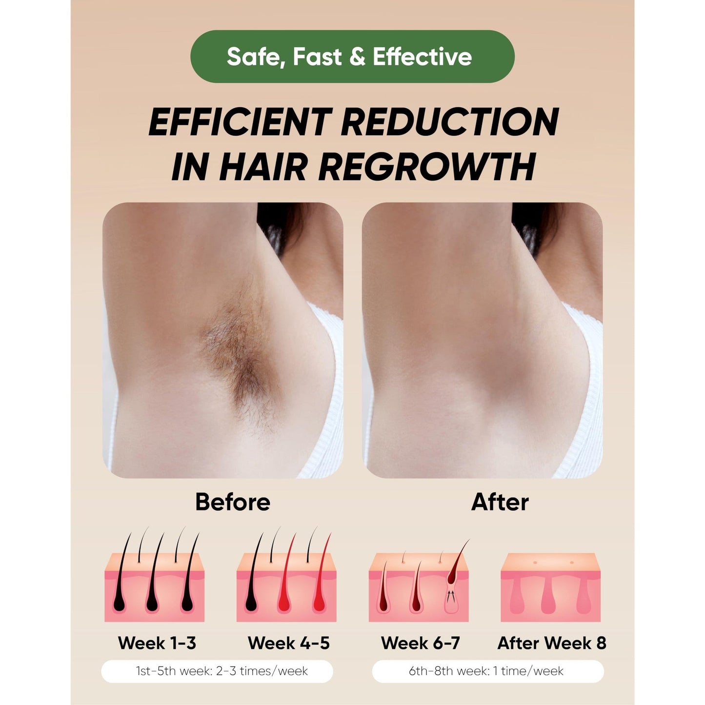 XSOUL At-Home IPL Hair Removal for Women and Men Permanent Hair Removal 999,999 Flashes Painless Hair Remover on Armpits Back Legs Arms Face Bikini Line, Corded - Medaid International