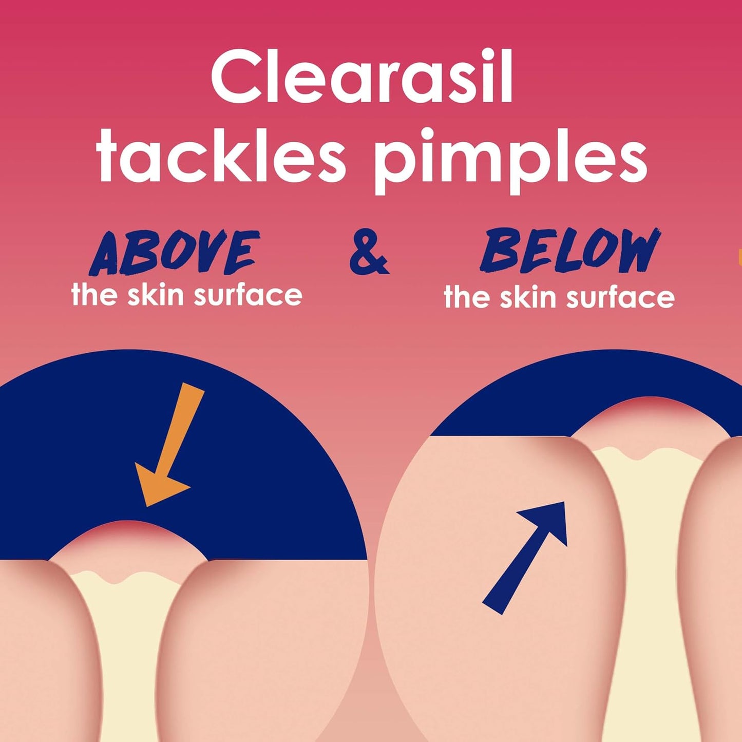 Clearasil Ultra Pore Cleansing Pads, 90 Count