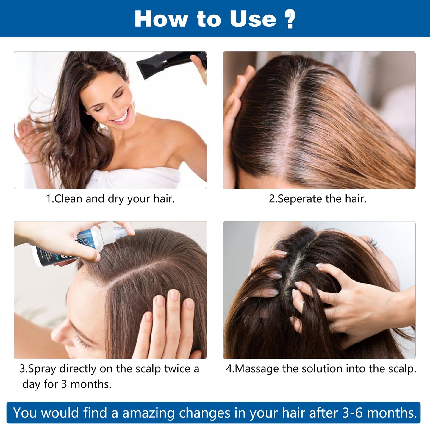 5% Minoxidil Hair Growth Serum for Men and Women - Hair Regrowth Treatment Spray, Topical Solution to Stop Thinning and Hair Loss, 2 Month Supply for Beard and Hair Growth, 100ML - Medaid International