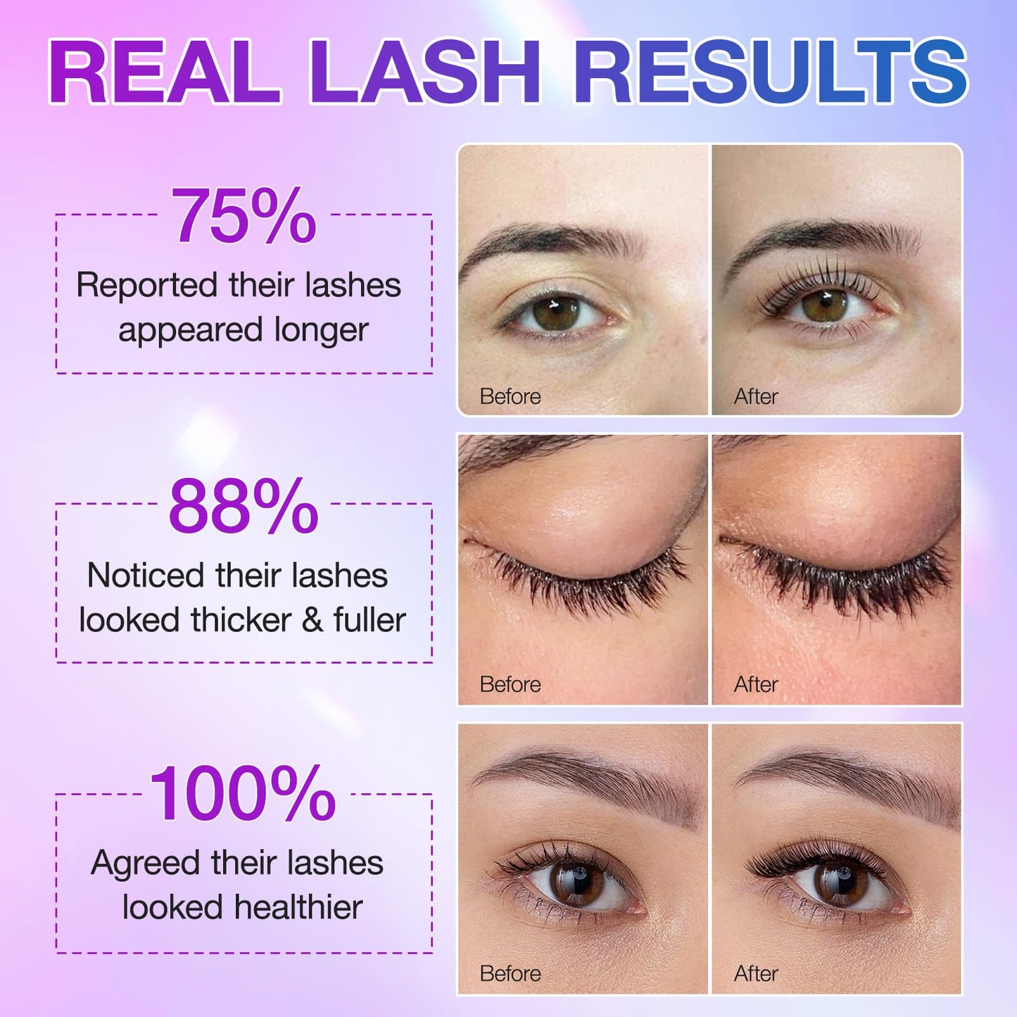 Advanced Eyelash Growth Serum for Longer, Fuller and Thicker Lashes in a Month - Women's Lash Enhancer (5ml) - Medaid International