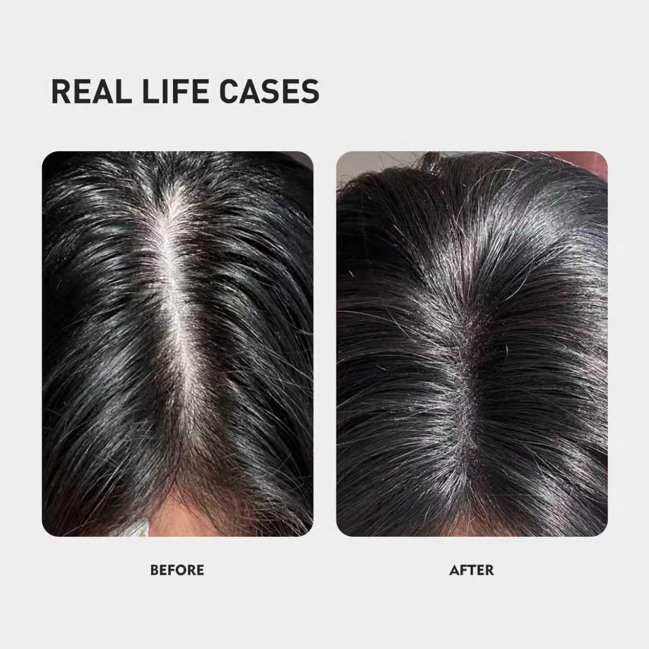 Kintor 0.5% KX-826 Hair Density Serums, DHT Blocker, Hair Repair, Thicker, Strengthening, Fuller-looking Healthier Hair, Reducing Hair Loss, for Men and Women, for All the Day, 60ml - Medaid International