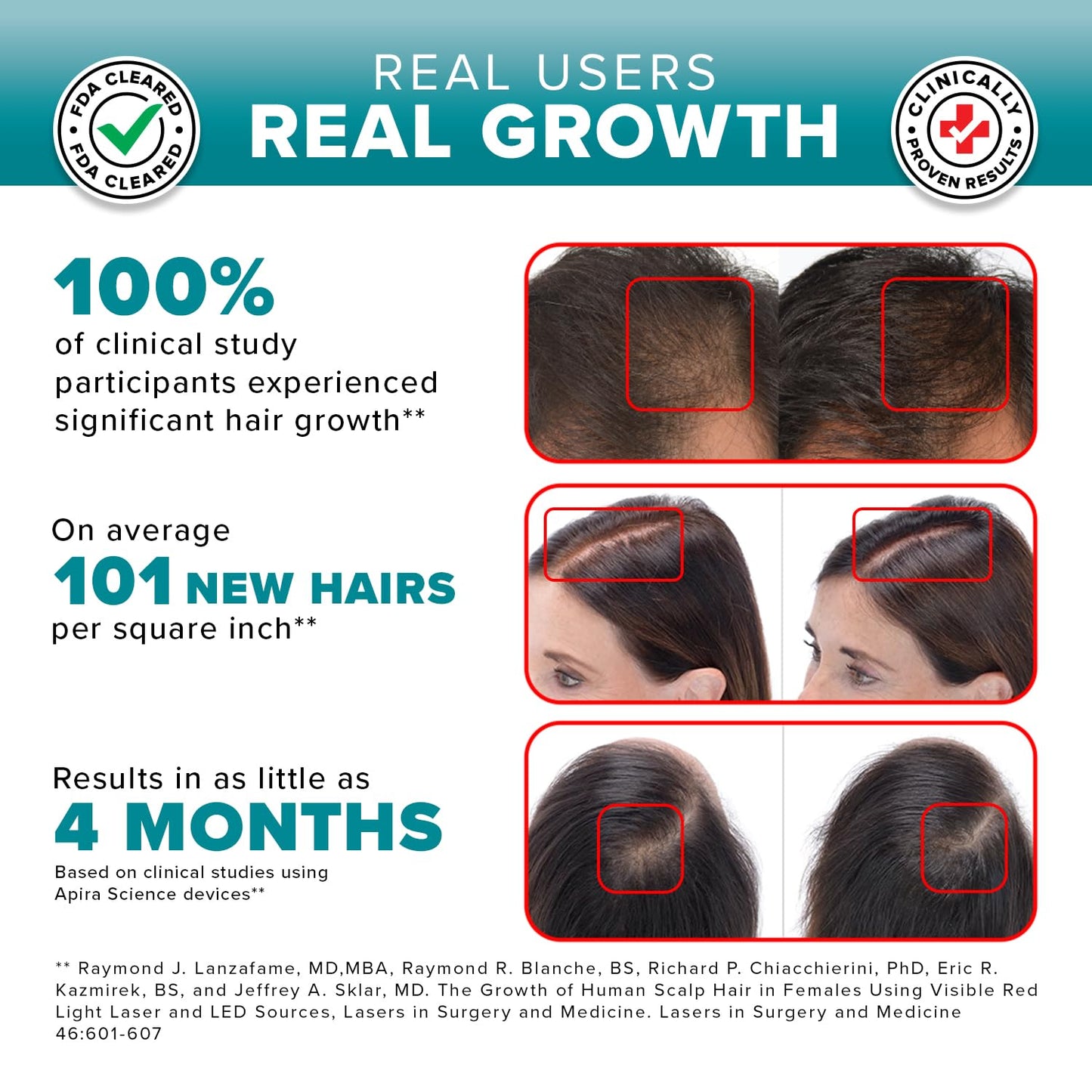 iGrow Laser Hair Growth System - Clinically Proven, FDA Cleared Laser Cap Hair Growth for Men & Women. - Medaid International