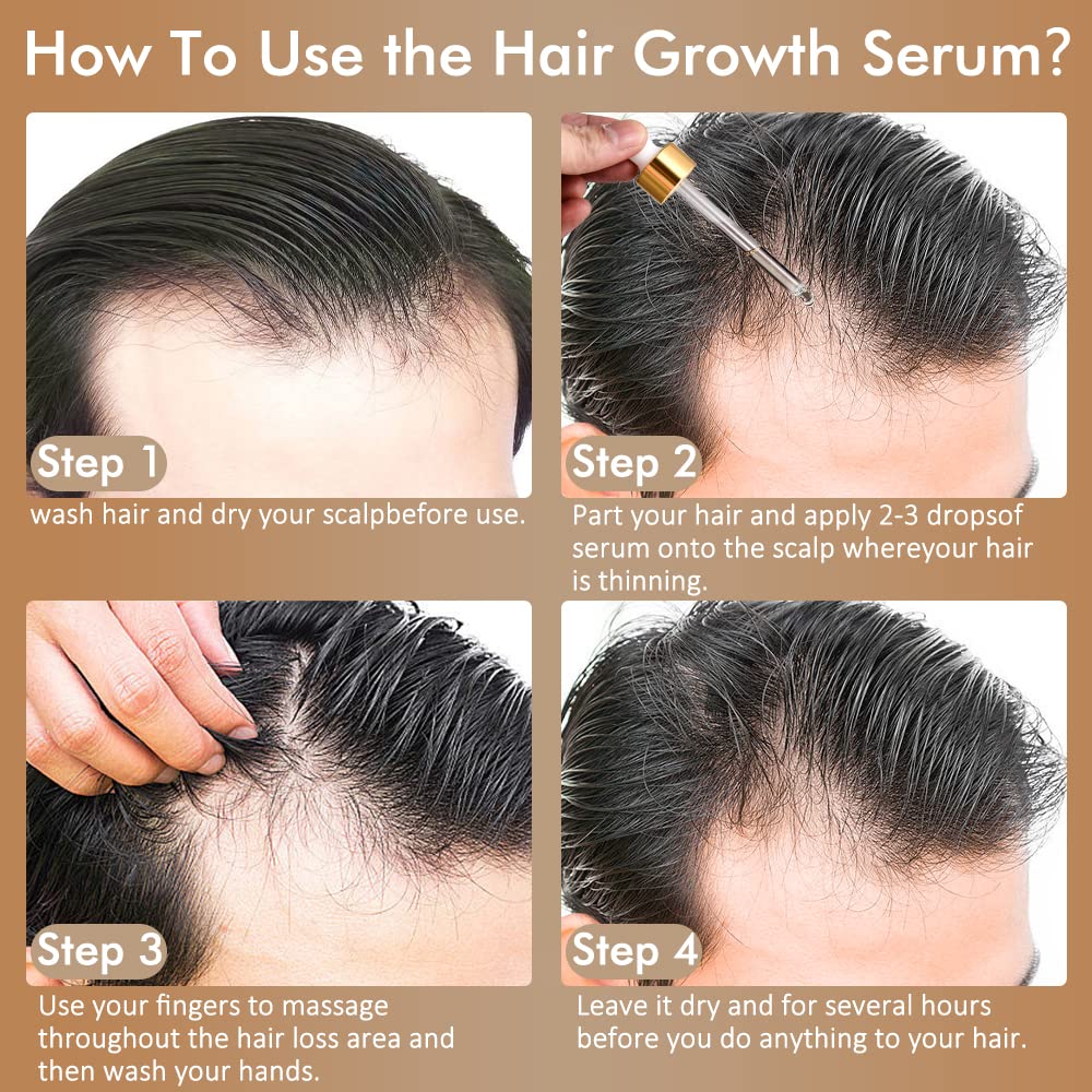 Dr.Yiman 5% Minoxidil Hair Growth Serum for Men and Women, Hair Growth Serum Oil for Hair Loss for Women, Safest Hair Growth Minoxidil Treatment for Boosting Follicles, Hair Regrowth Treatments - Medaid International