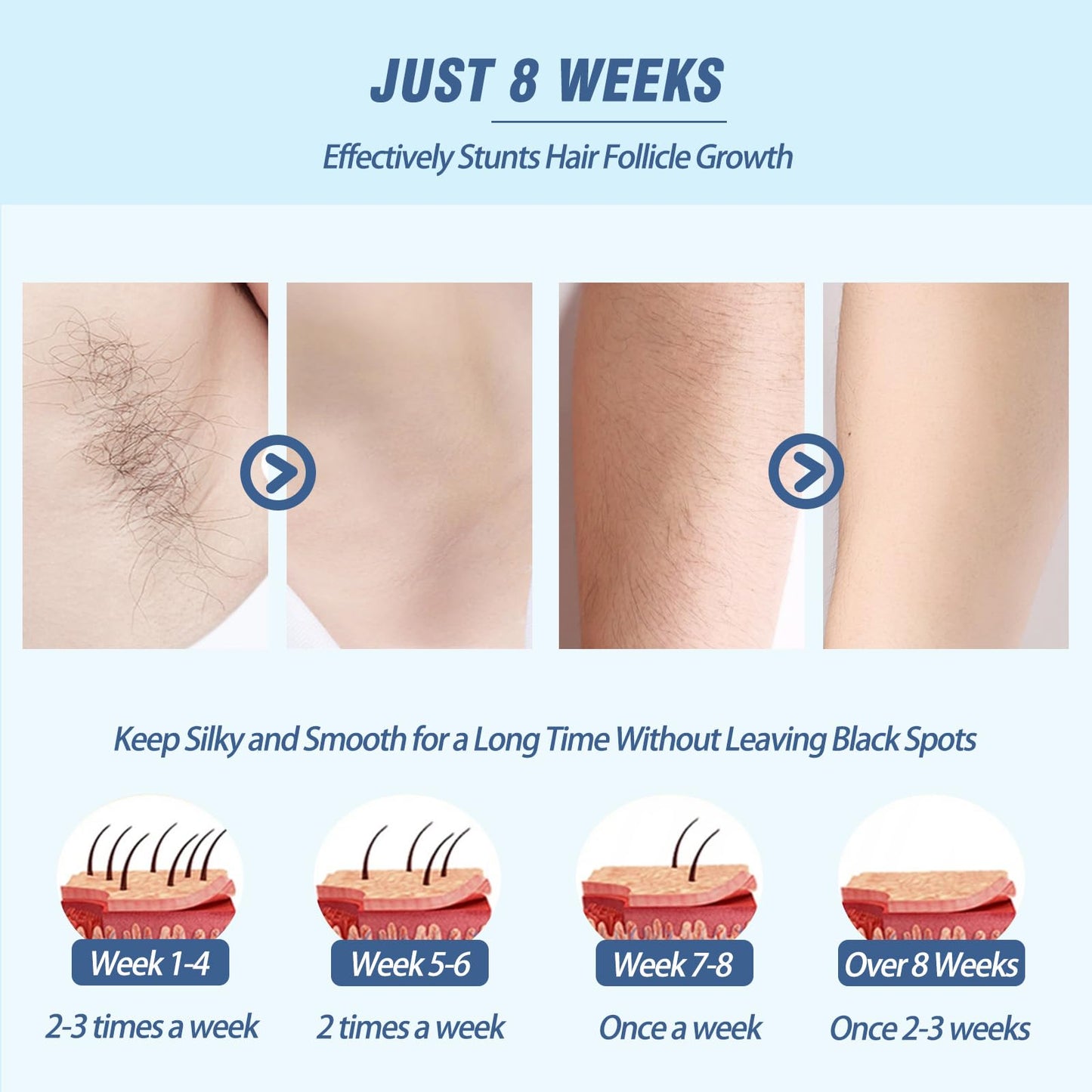 Laser Hair Removal for Women Men Permanent IPL Hair Remover Device for Home Use with 5 Levels Mini Painless Use for Body & Face, Corded - Medaid International