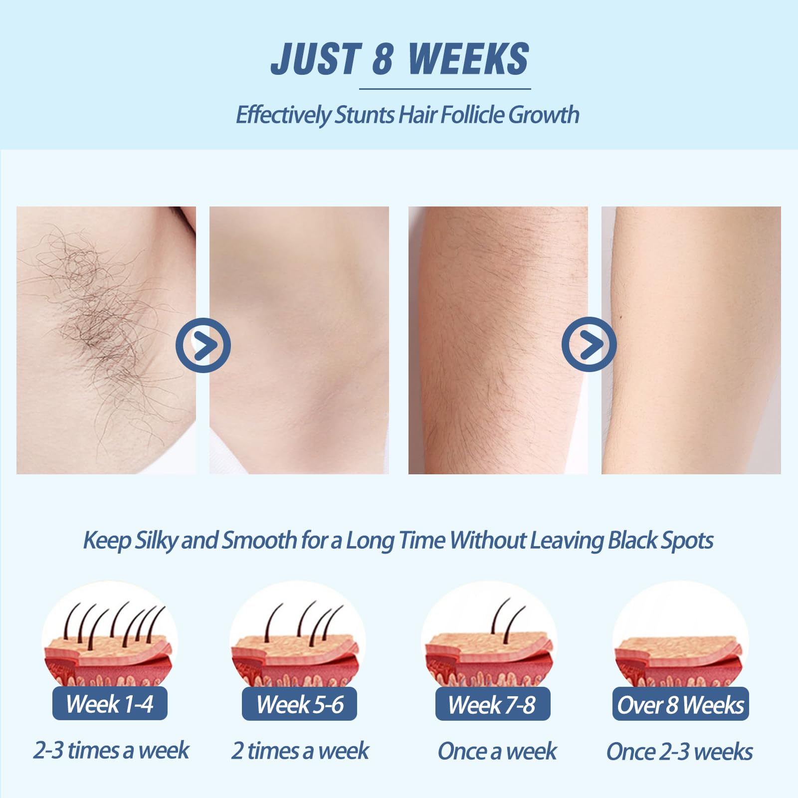 Laser Hair Removal for Women Men Permanent IPL Hair Remover Device for Home Use with 5 Levels Mini Painless Use for Body & Face, Corded - Medaid International
