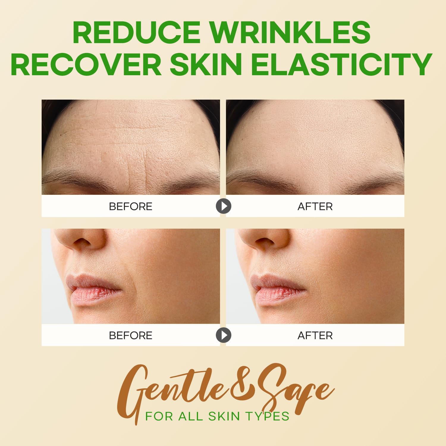 SILKDERMIS Forehead Wrinkle Patches 12Pcs with Smile Line Patches 24Pcs with Aloe, Collagen, Vitamin E, Forehead Wrinkles Treatment and Smile Lines Treatment - Medaid International