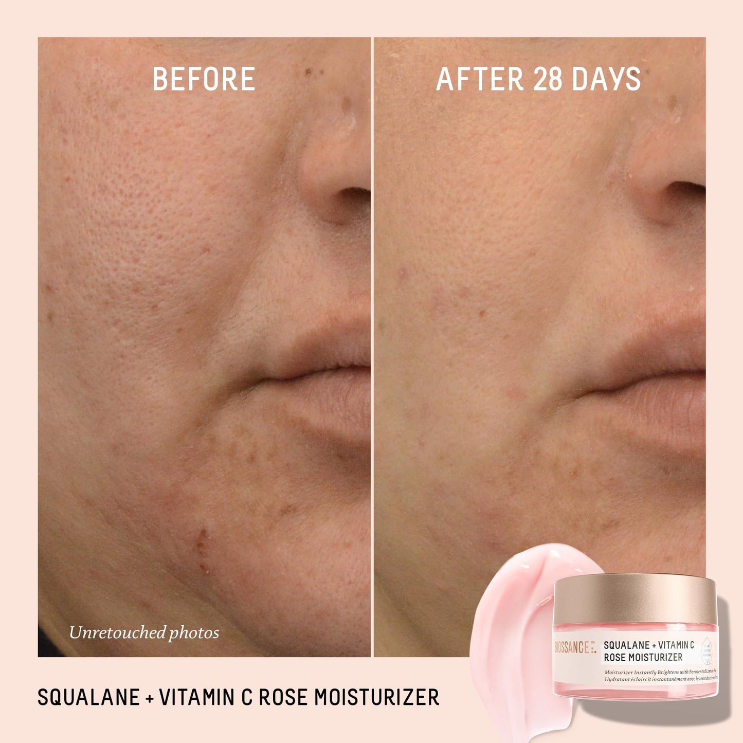 BIOSSANCE Squalane + Vitamin C Rose Face Moisturizer – Antioxidant-Rich Day/Night Face Lotion – Hydrates and Smooths Fine Lines – Even Skin Tone & Reduce Discoloration – For Radiant Skin, 1.69 Fl Oz - Medaid International