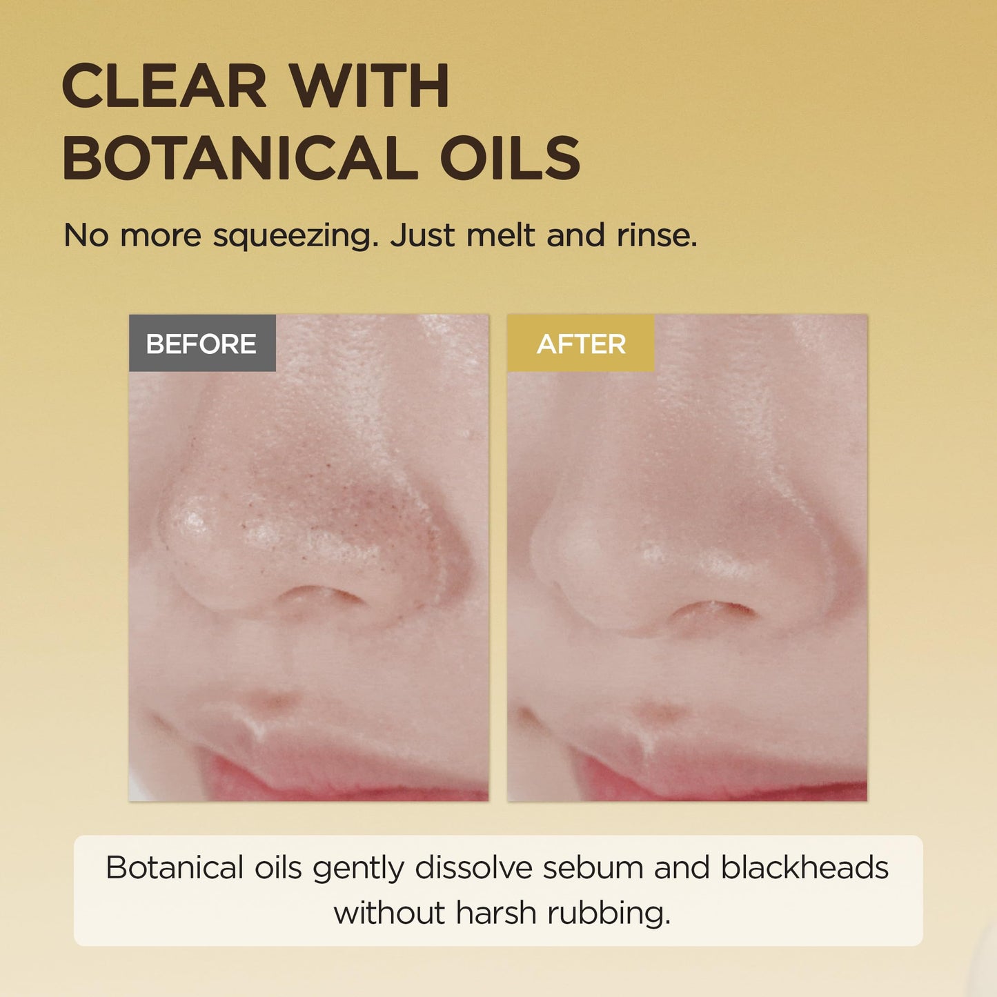 SKIN1004 Madagascar Centella Light Cleansing Oil 6.76 fl.oz, 200ml | Gentle Oil Cleanser for Face, Korean Facial Cleanser, Double Cleansing - Medaid International