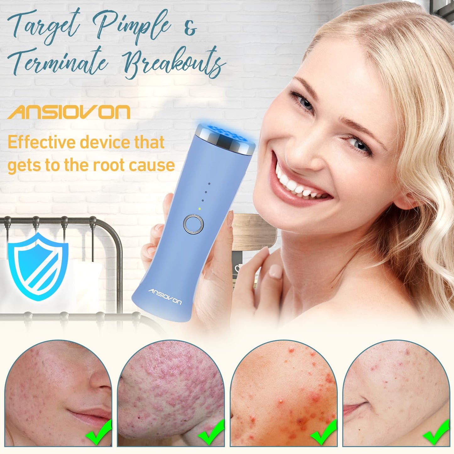 ANSIOVON Blue Light Therapy Device for Acne Spot Treatment - LED Acne Blue Light Therapy Wand for Face - Medaid International