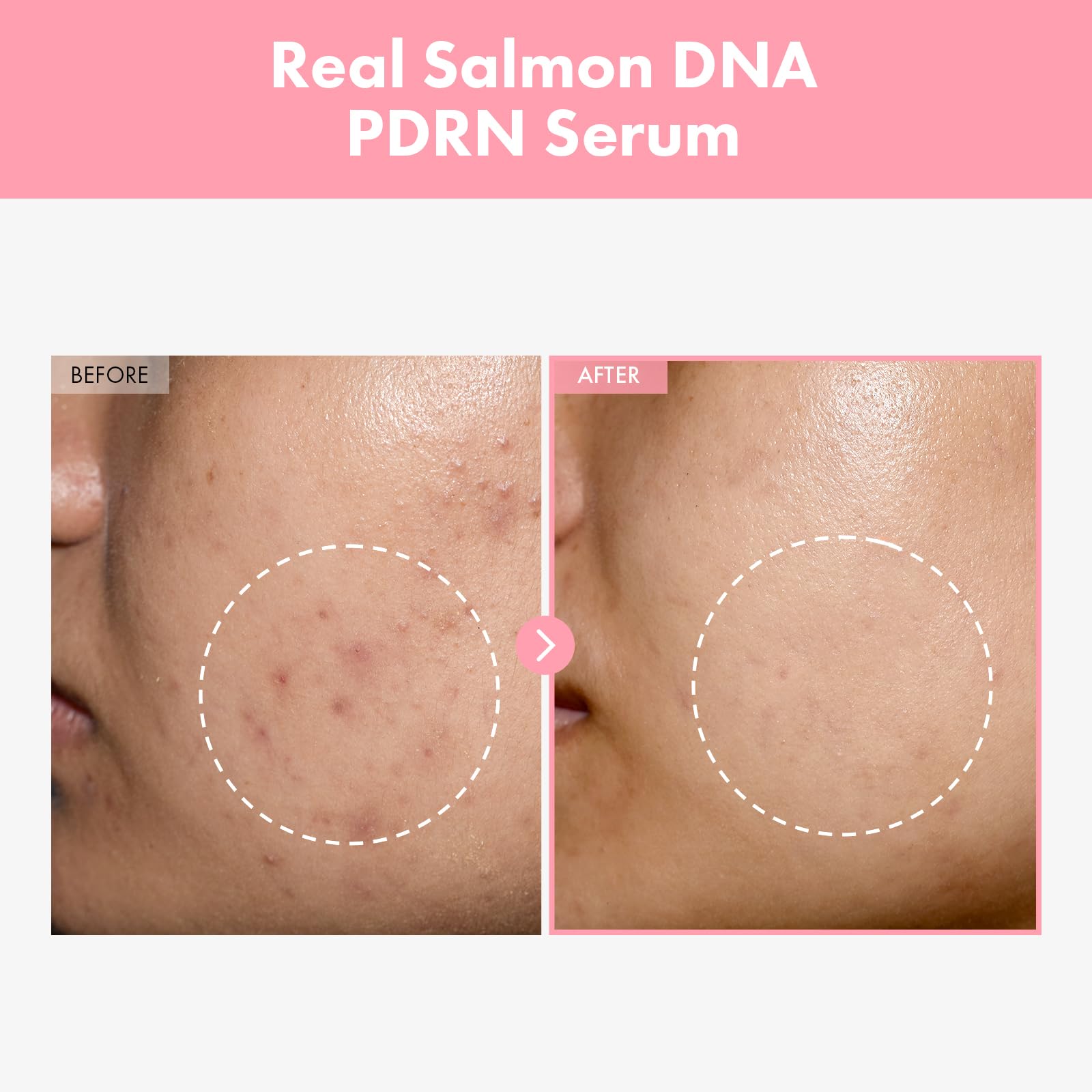 TOSOWOONG Pink Peptide 12 PDRN Serum With Salmon DNA PDRN 10,320ppm, 12 Peptides, Niacinamide, Skin glow, Hydrating, Moisturizing, Firming, Uneven Skin Tone, Korean Skincare, 33ml, 1.11 fl.oz. - Medaid International