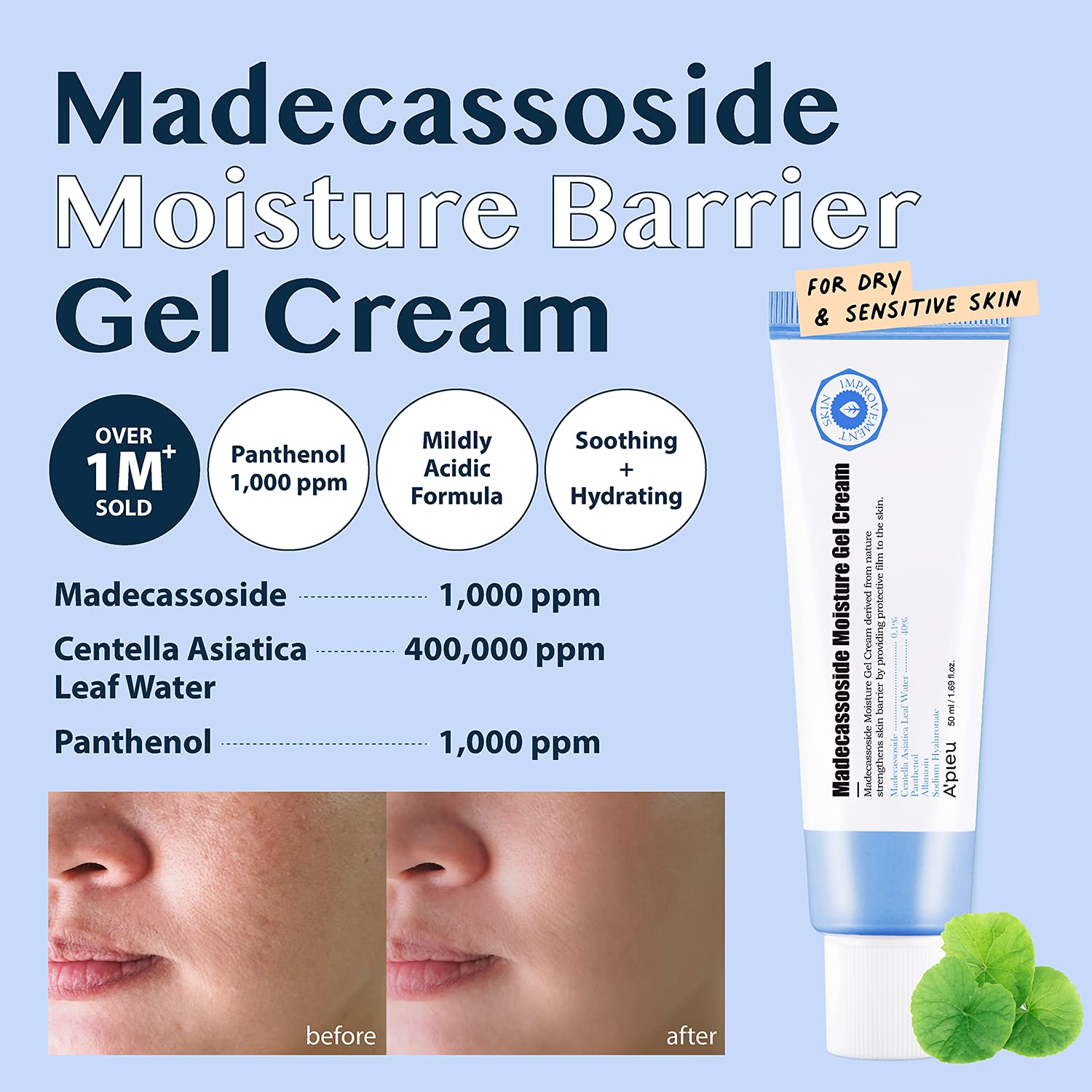 A’PIEU Madecassoside Skincare Bundle – Moisture Gel Cream & Tetrasome Cica Cream (2 x 1.69 fl oz) – Hydrating & Calming Set for Dry, Sensitive, and Combination Skin – Centella Asiatica, Panthenol - Medaid International