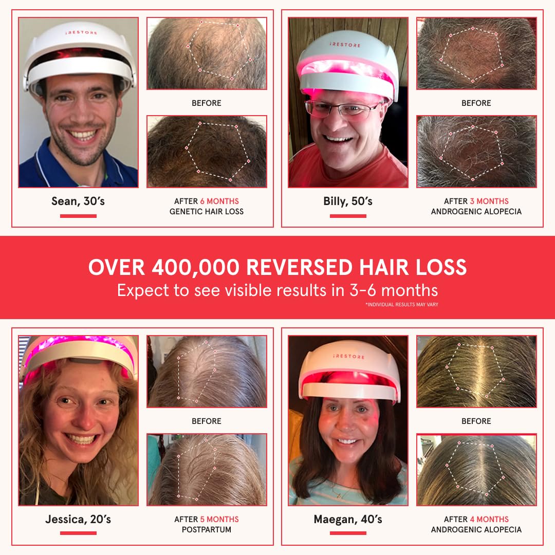 iRestore Essential - Laser Red Light Therapy for Hair Growth - FDA Cleared Hair Loss, Hair Thinning & Alopecia Treatment for Men & Women - Laser Cap for Hair Regrowth Stimulate Denser Fuller Hair - Medaid International
