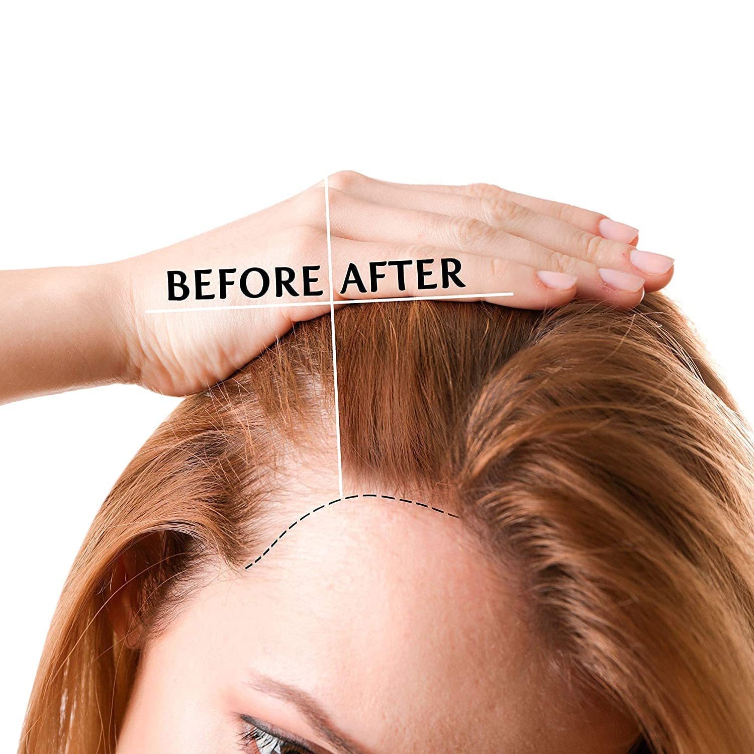 Luv Me Care Biotin Hair Growth Oil Hair Growth Serum for Thicker Longer Fuller Healthier Hair, Prevent Hair Loss & Thinning, All Natural Vitamin Rich Treatment, Women & Men, All Hair Types 1.7 oz - Medaid International