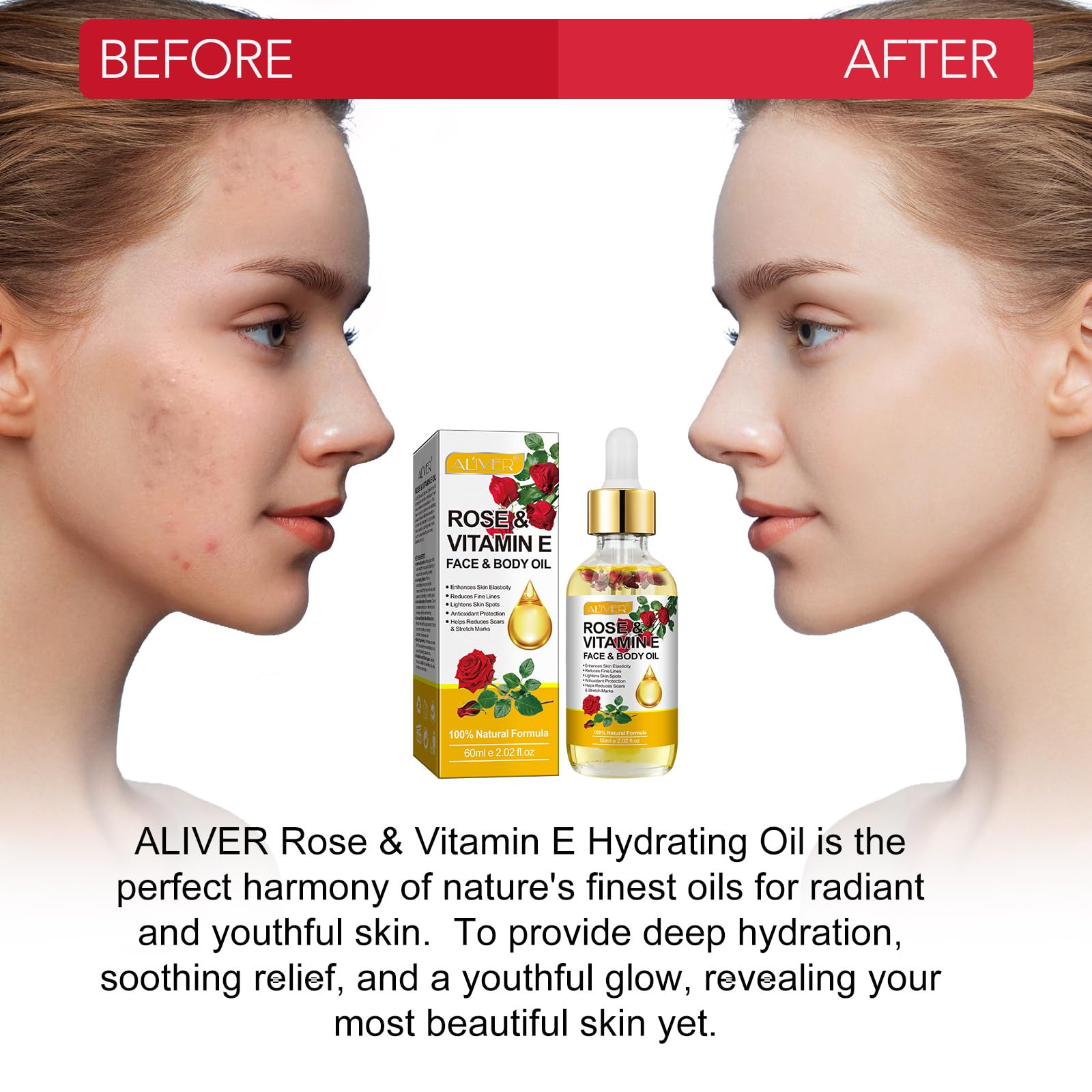 RoongDuuDll Rose Oil for Face with Rose Petal Flower, Natural Vitamin E Oil for Anti-aging, Scars & Stretch Mark, Gua Sha Face Oil, Massage Body Oil Scented for Dry Skin, Scalp and Nail - 60ml - Medaid International
