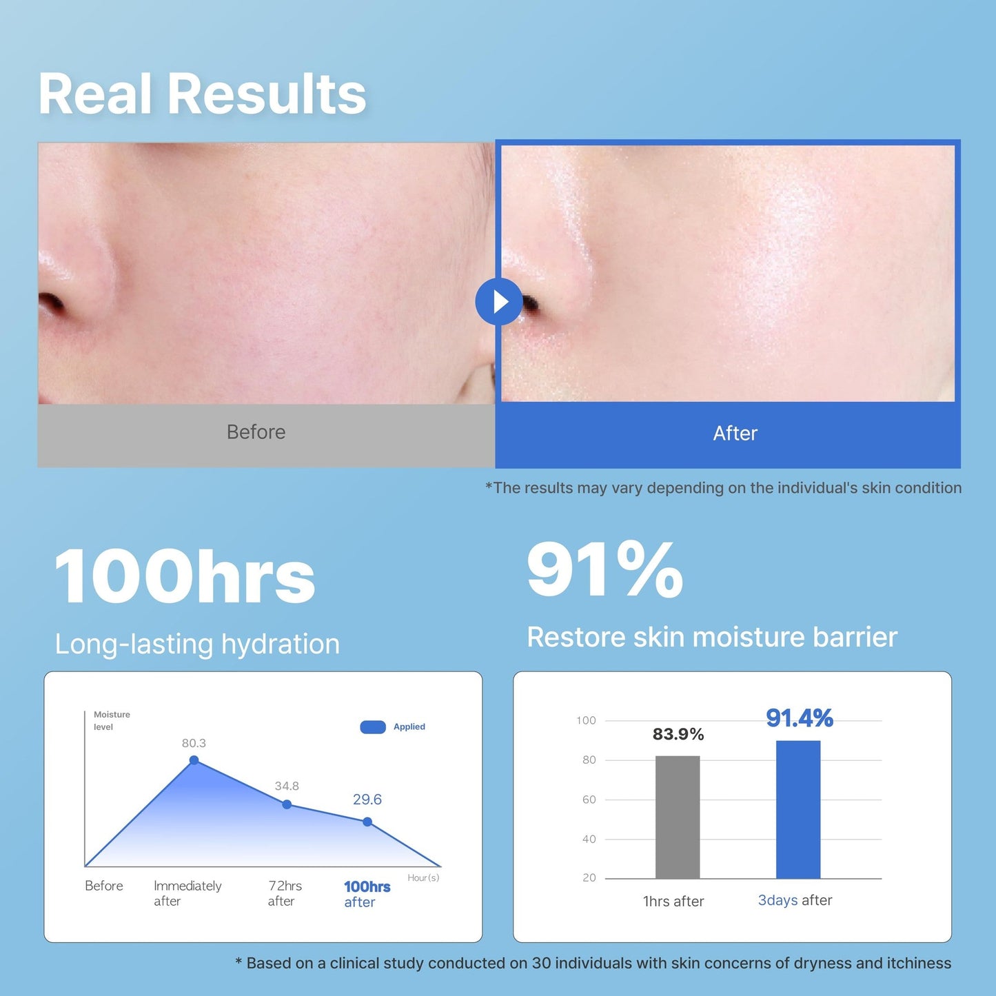 Illiyoon Ceramide Ato Concentrate Cream | Moisturizer for Dry & Sensitive Skin, 100hr Lasting Hydration, For Face & Body, Gentle for Infants, Moisture Barrier Repair, Vegan Certified, 2.53 fl.oz. - Medaid International