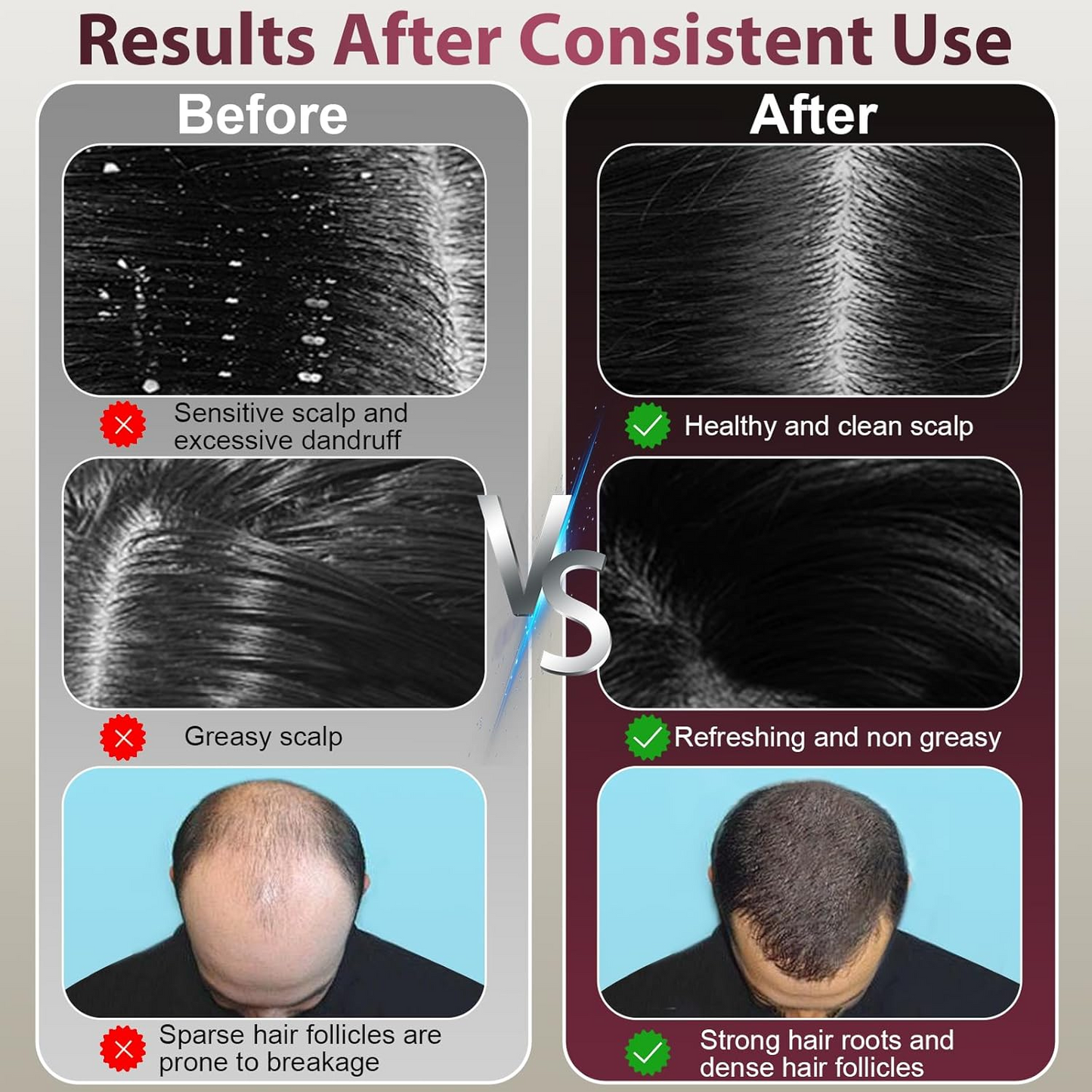 Laser Therapy Hair Growth Comb ‚Äì Electric Scalp Massager & Hair Oil Applicator Waterproof - Medaid International