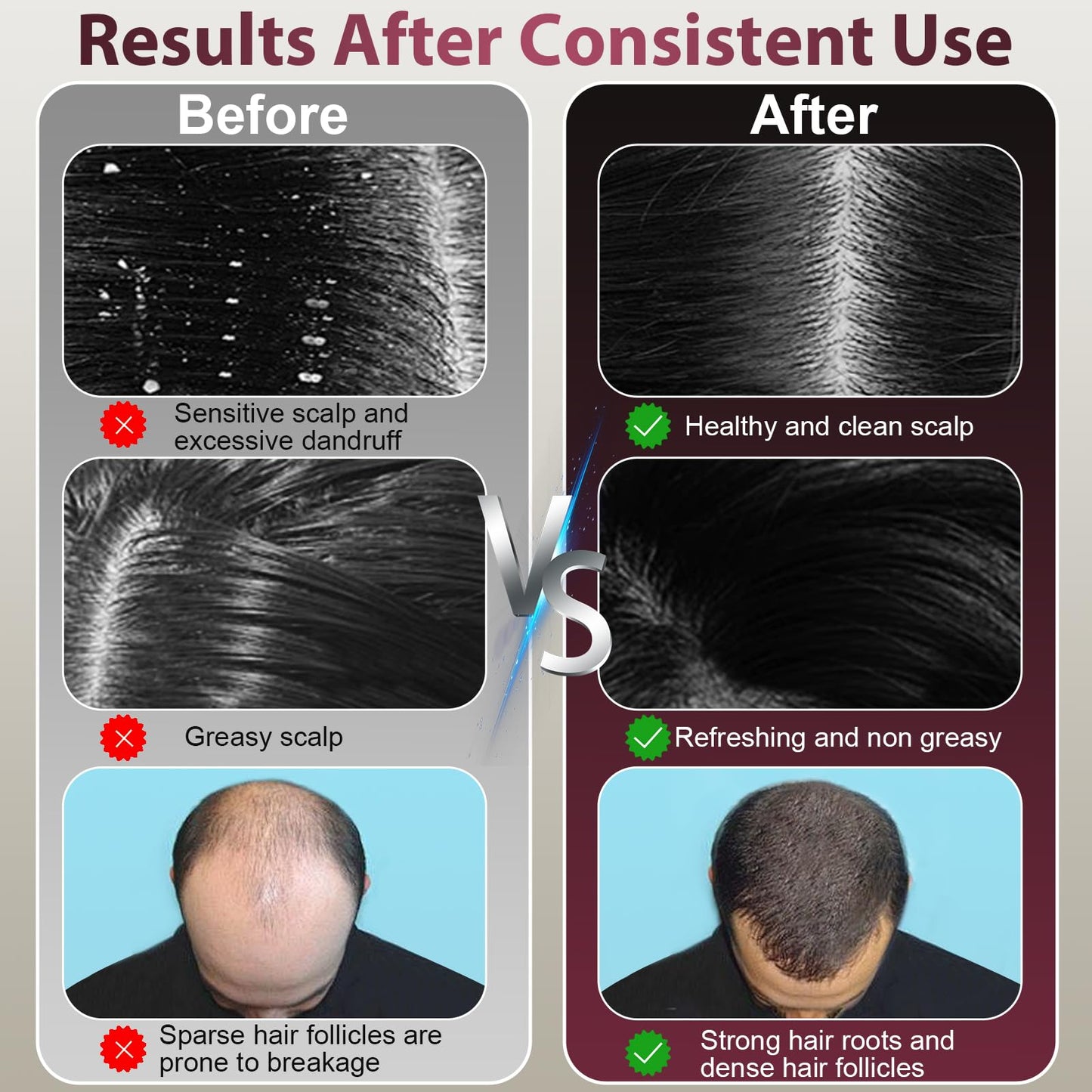Laser Therapy Hair Growth Comb, Hair Oil Applicator,Electric Scalp Massager Hair Growth with IPX7 Waterproof - Medaid International