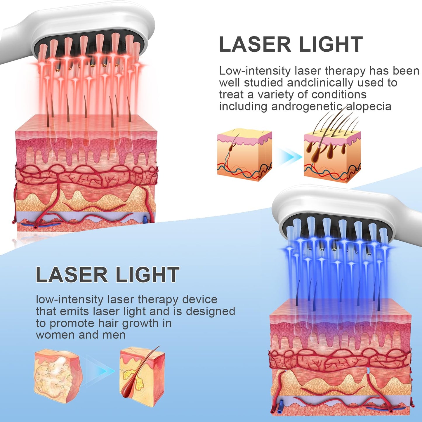 Laser Hair Growth Comb - Handheld Laser Hair Growth Comb - Medaid International