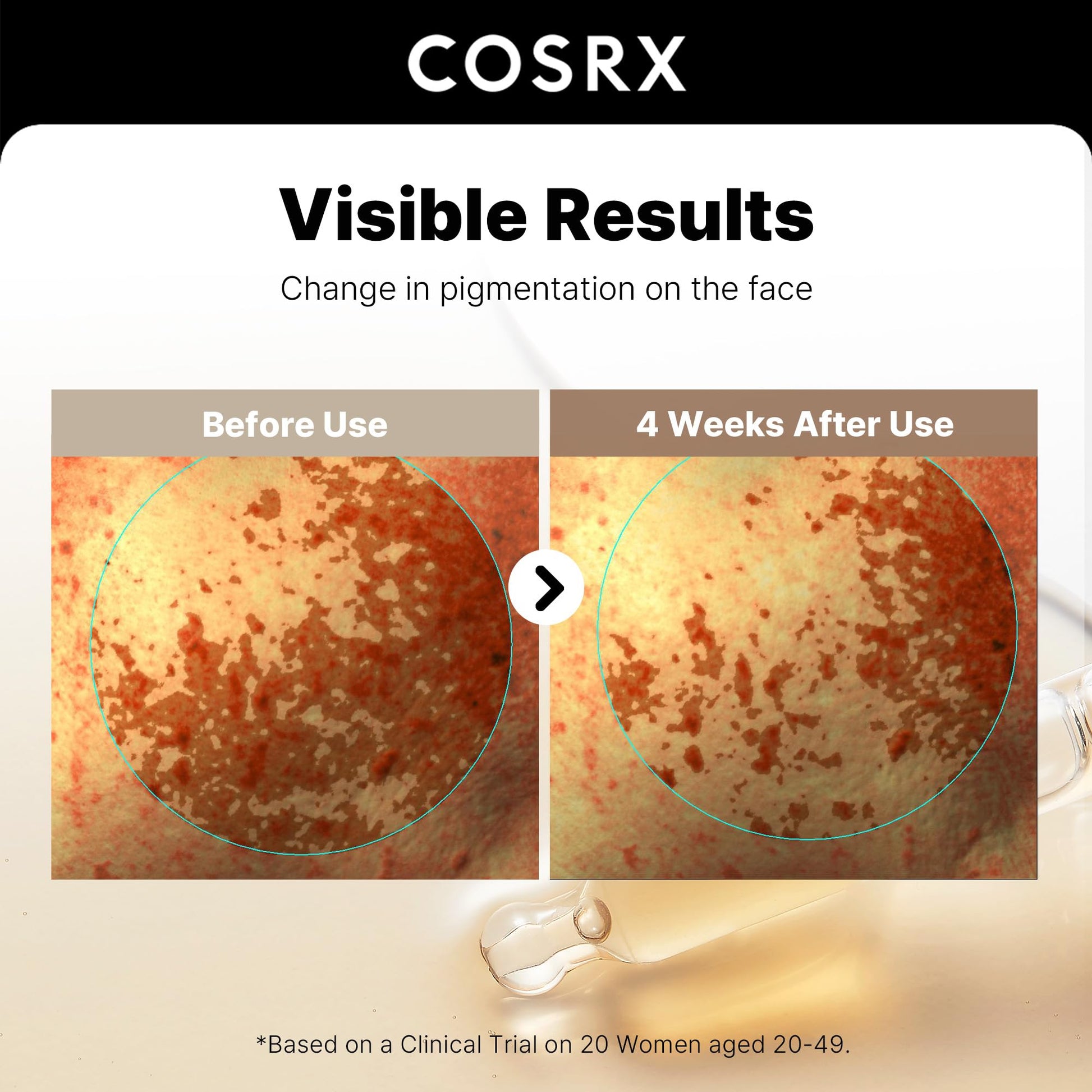 COSRX 2% Alpha Arbutin Discoloration Care Face Serum with Niacinamide, Glutathione & Tranexamic Acid, 1.7 fl oz – Serum for Face, Korean Skin Care - Medaid International