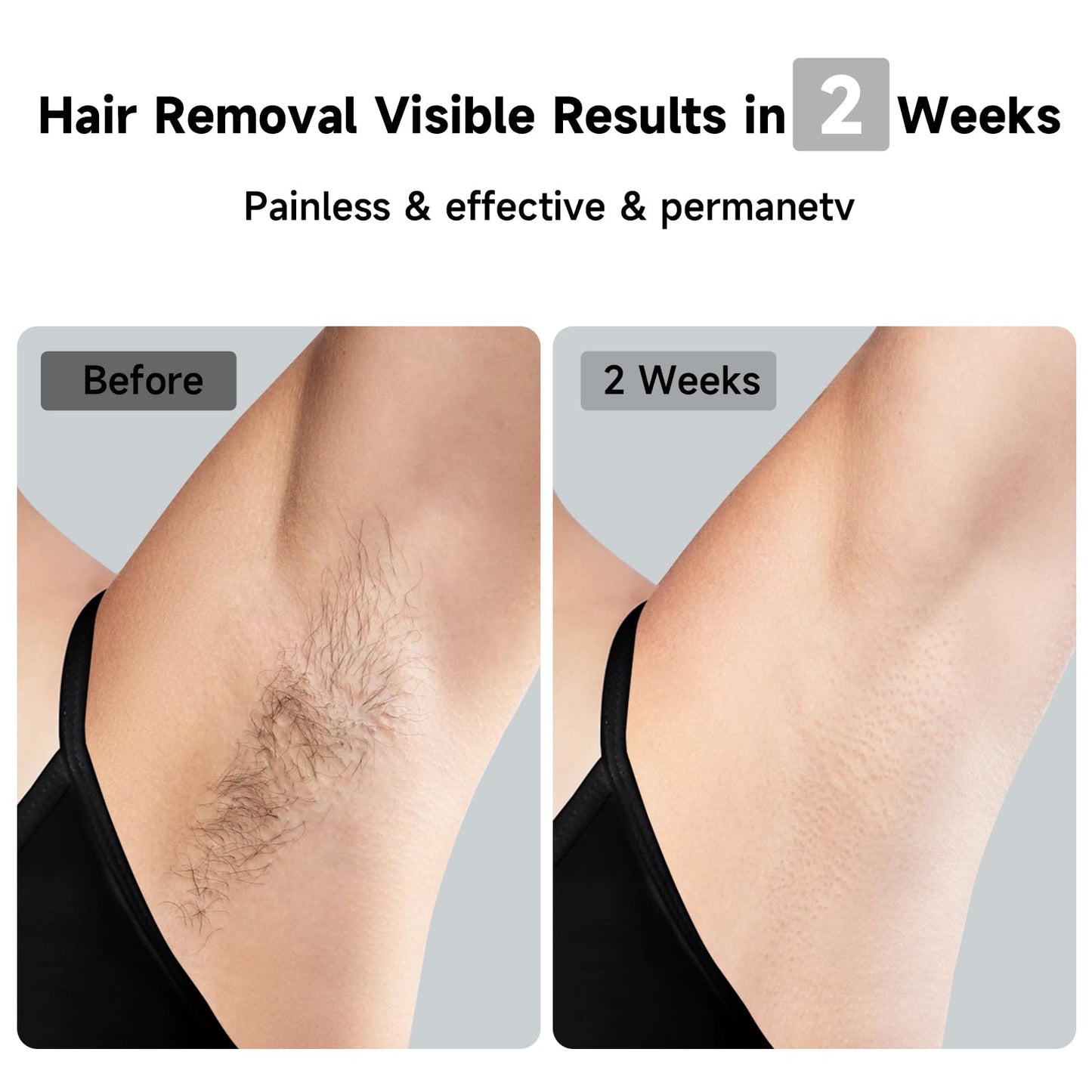 JOVS Laser Hair Removal, 37°F Painless Hair Removal Device with Sapphire Ice-Cooling, 3 in 1 Hair Removal & Skin Rejuvenation for Women and Men, 8 Modes Skin Care for Whole Body, Touch Screen, White - Medaid International
