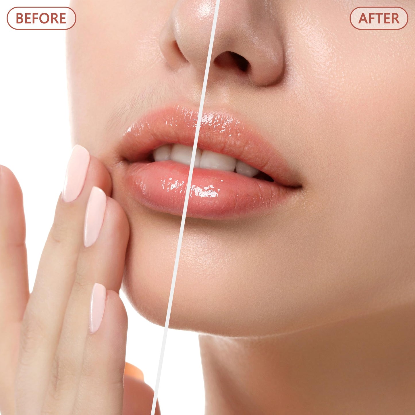 Facial Hair Remover for Women - as Seen on TV Painless Face Shaver - Electric Hair Removal Device for Face Lips Peach Fuzz with Light (Rose Gold) - Medaid International