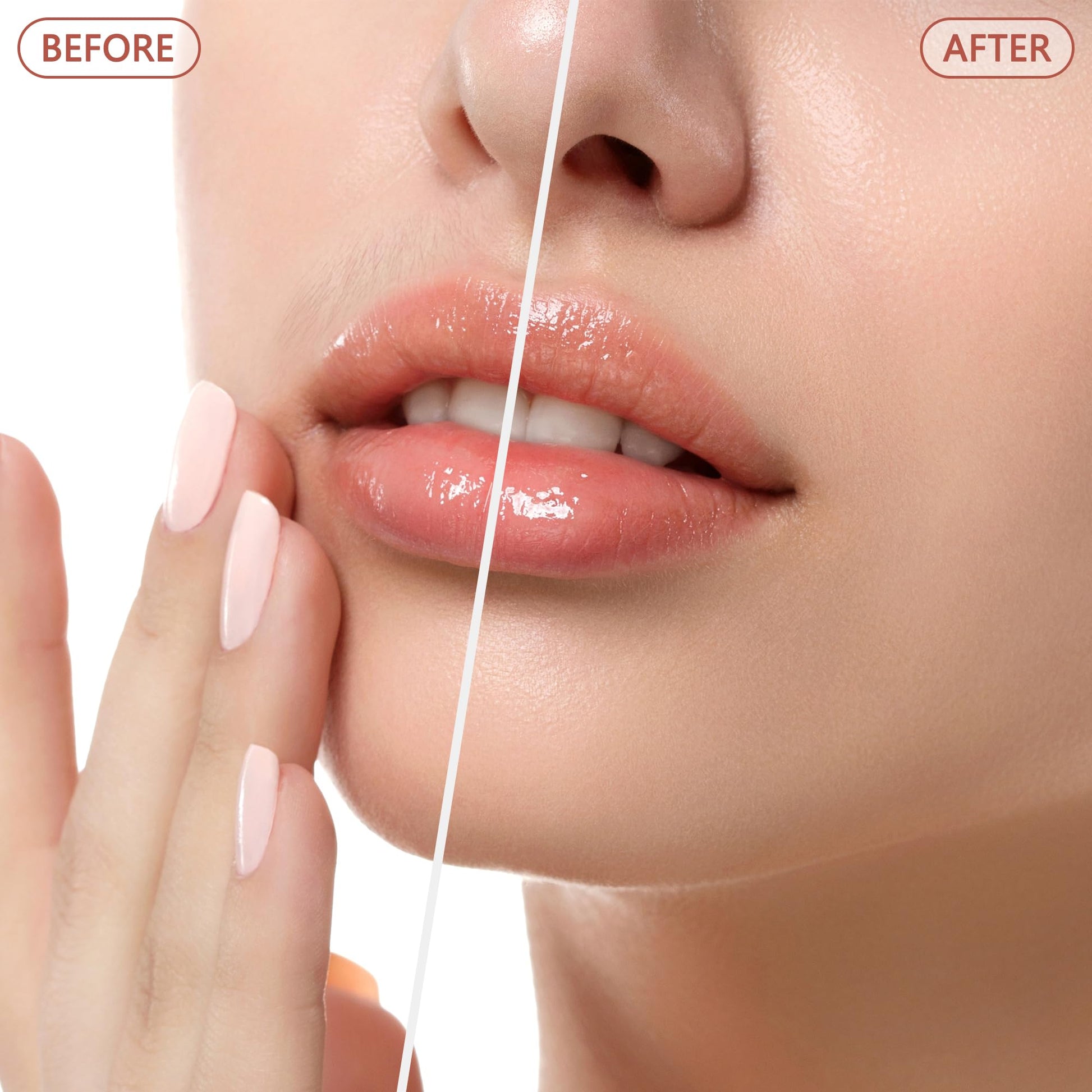 Facial Hair Remover for Women - as Seen on TV Painless Face Shaver - Electric Hair Removal Device for Face Lips Peach Fuzz with Light (Rose Gold) - Medaid International