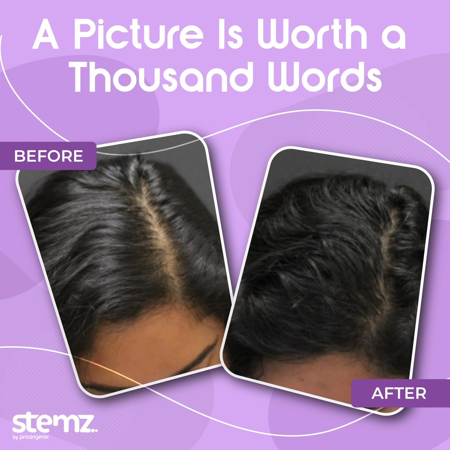 Stemz for Women - Hair Follicle Stimulator - Natural Alternative to Minoxidil and Hair Growth Oil - Sea Moss Peptides to Support Hair Growth - Delivers Results in 90 Days - Medaid International