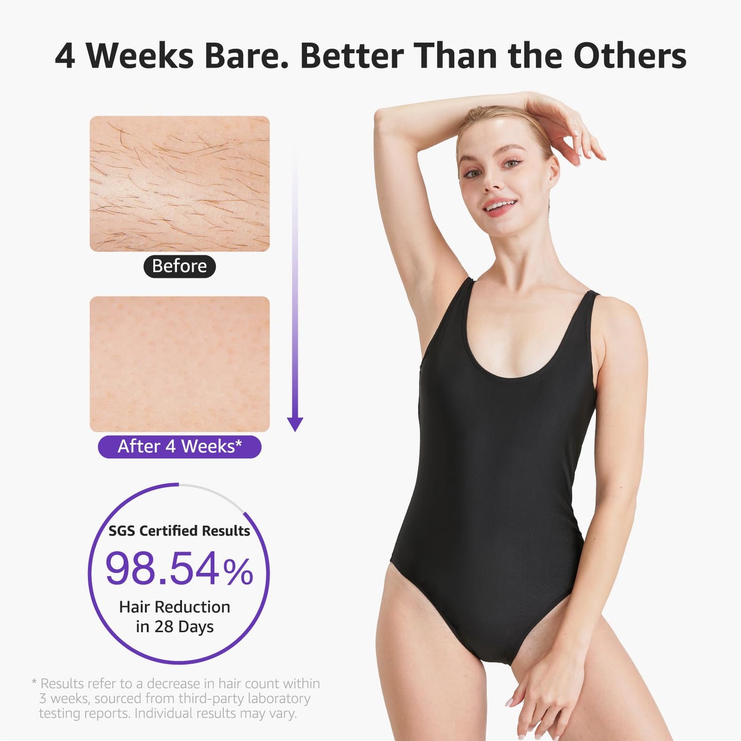 IPL Laser Hair Removal Device For Women: Permanent Hair Removal With Ice-Cooling Care Function, to 999,999 Flashes Nearly Painless & Long-Lasting Results For Fast Full Body, Holiday Gifts Purple - Medaid International