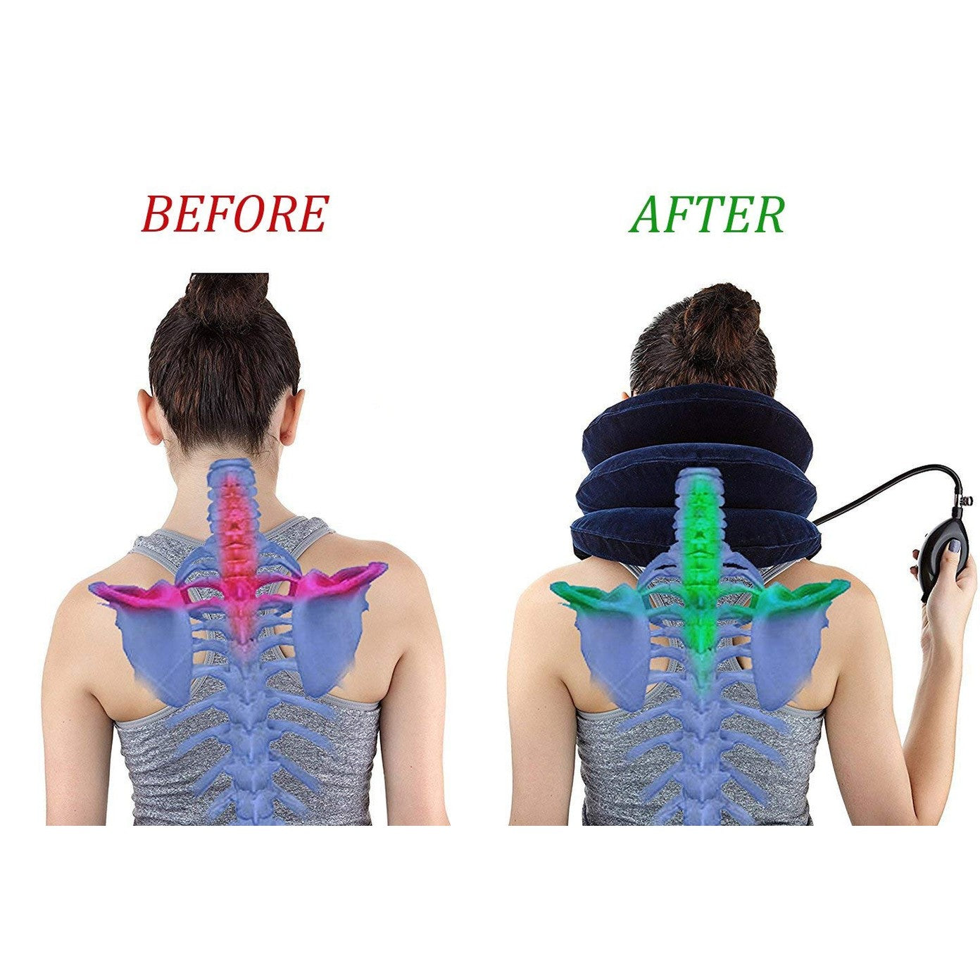 Cervical Neck Traction Device Inflatable Neck Stretcher, Easy to Use for Chronic Neck and Shoulder Pain Relief Traction Spine Alignment, Neck Cervical Brace，Blue - Medaid International