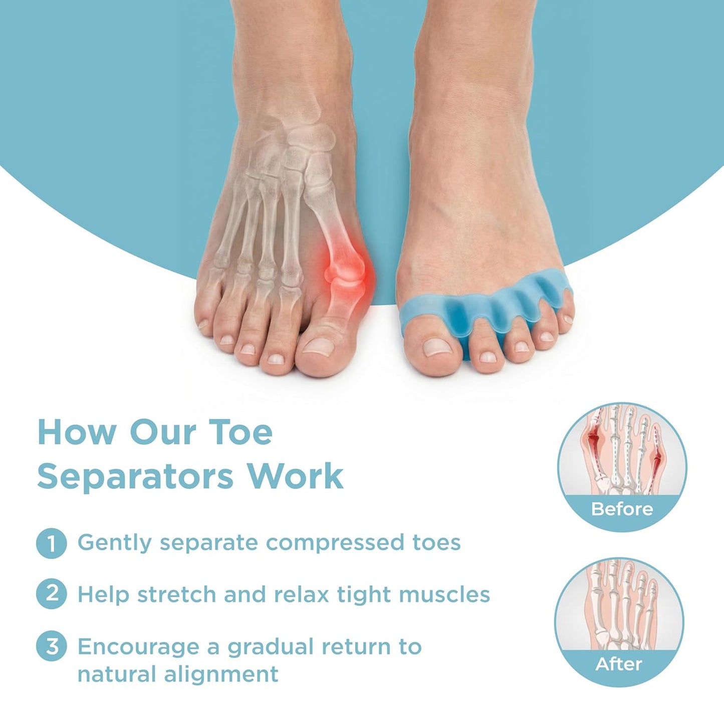 Toe Separator Corrector Pair