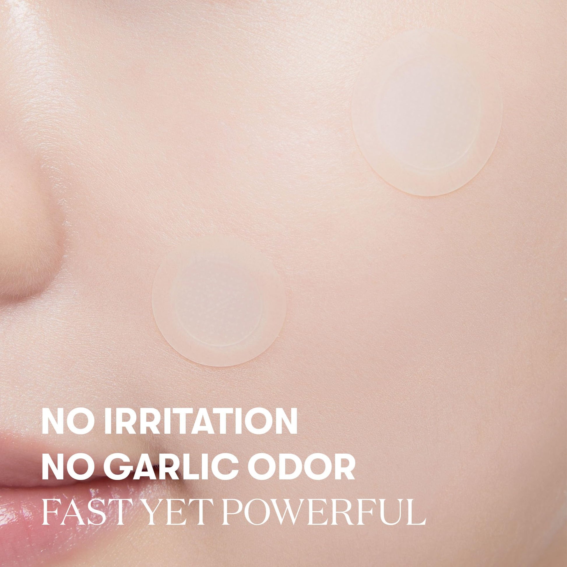 VT COSMETICS Garlic AC Reedle Shot Point Patch, Spot Patch for Early-Stage Blemishes (9 Patches) - Medaid International