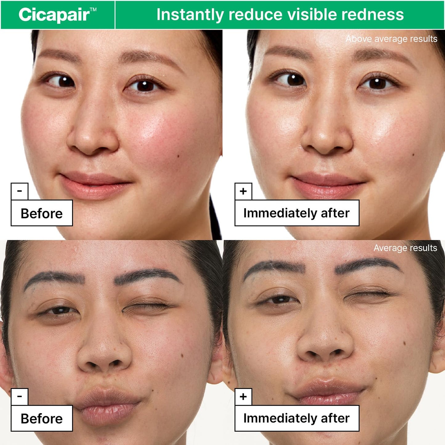 Dr.Jart+ Cicapair Sensitive Skin Korean Face Moisturizer for Redness and Barrier Repair with Centella Asiatica | Korean Skin Care | Travel Size, 0.51 Fl Oz - Medaid International