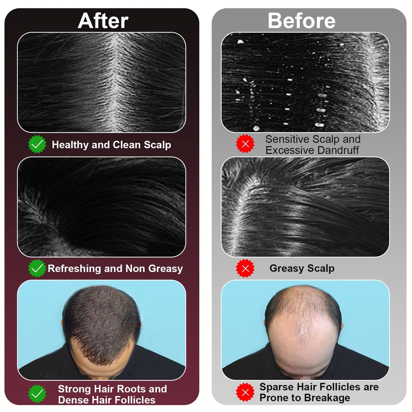 MERNUNUX Laser Therapy Hair Growth Comb, 3 in 1 Hair Oil Applicator for Hair Care, 360° Electric Scalp Massager, Stimulates Hair Regrowth for Men & Women, IPX7 Waterproof - Medaid International