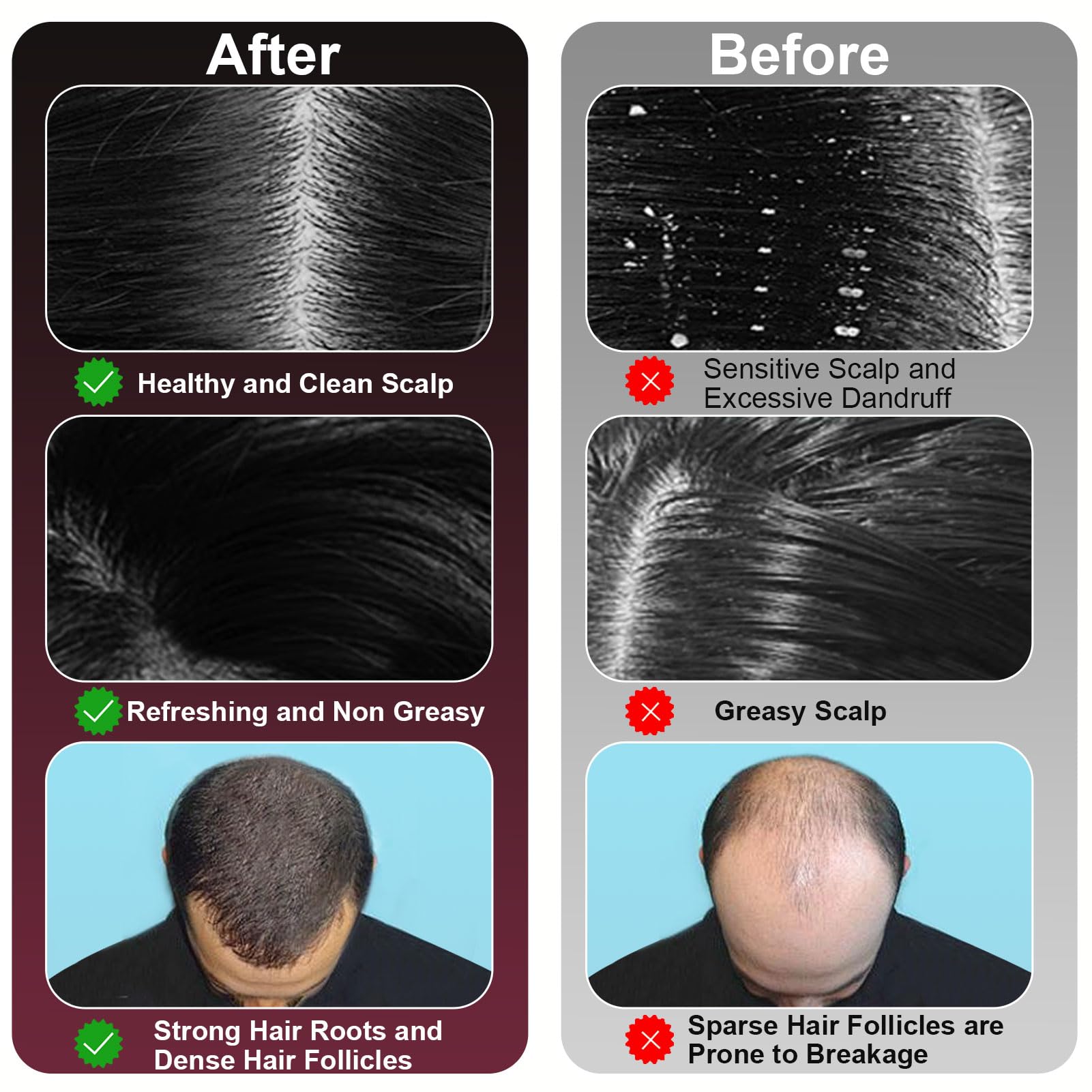 MERNUNUX Laser Therapy Hair Growth Comb, 3 in 1 Hair Oil Applicator for Hair Care, 360° Electric Scalp Massager, Stimulates Hair Regrowth for Men & Women, IPX7 Waterproof - Medaid International