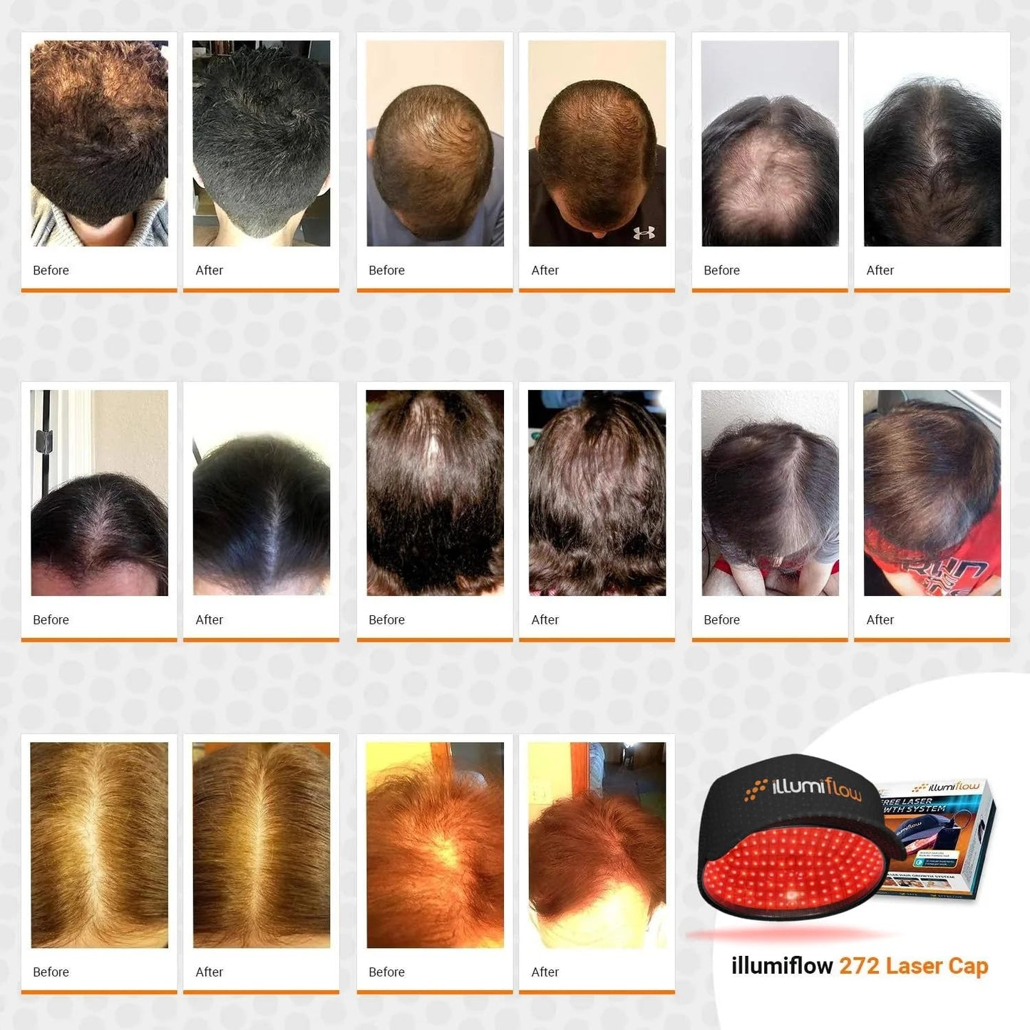 illumiflow 272 Laser Cap for Hair Growth - FDA Cleared Low Level Laser Therapy Hair Regrowth System for Men & Women - Hair & Scalp LLLT Hat w/Lasers Stops Hair Loss & Regrows Thinning Hair - Medaid International