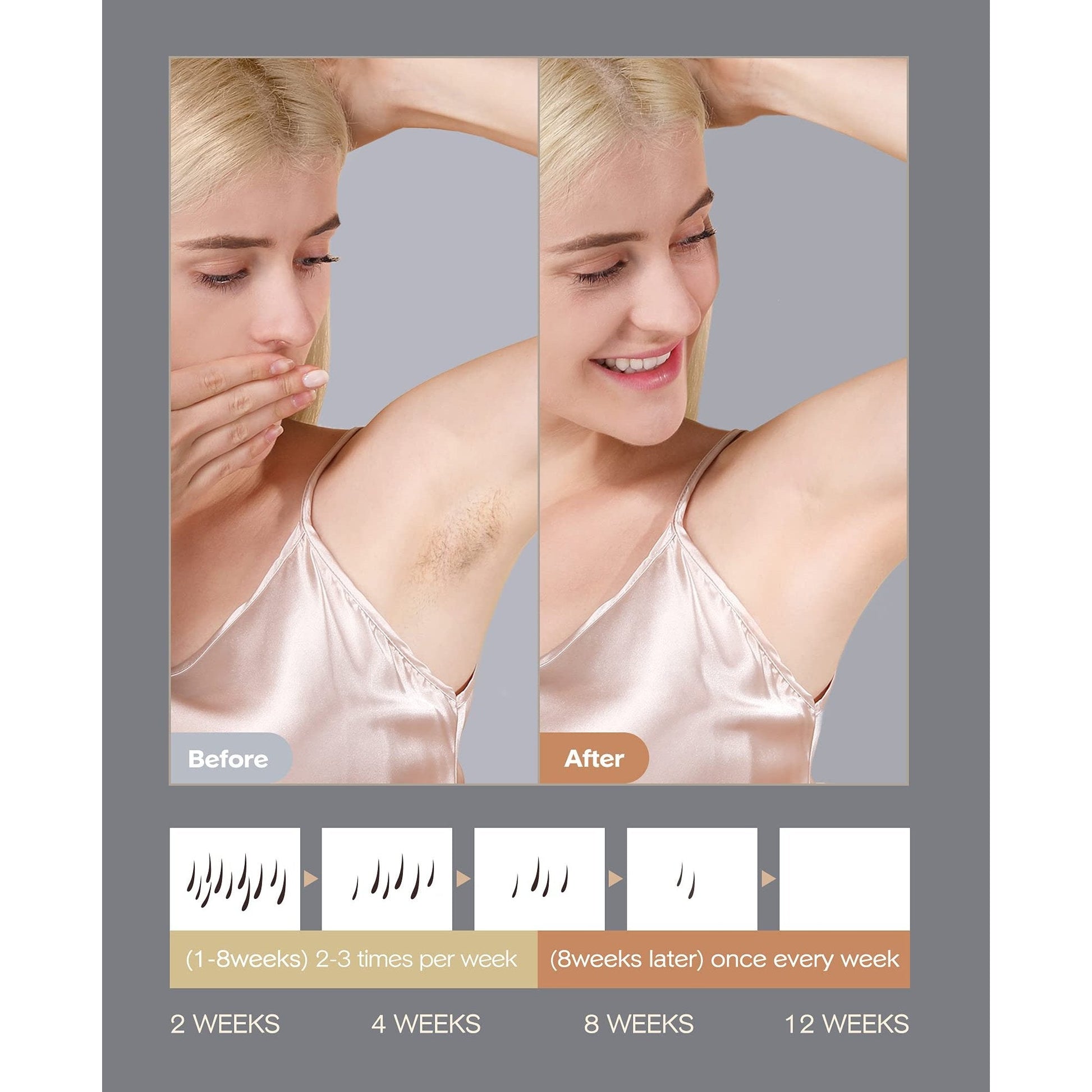 INNZA Laser Hair Removal Device with Sapphire Ice Cooling Function,Upgraded 999999 Flashes IPL Hair Removal Permanent for Women and Men,Depiladora Laser for Facial,Body, Bikini Line,Corded - Medaid International