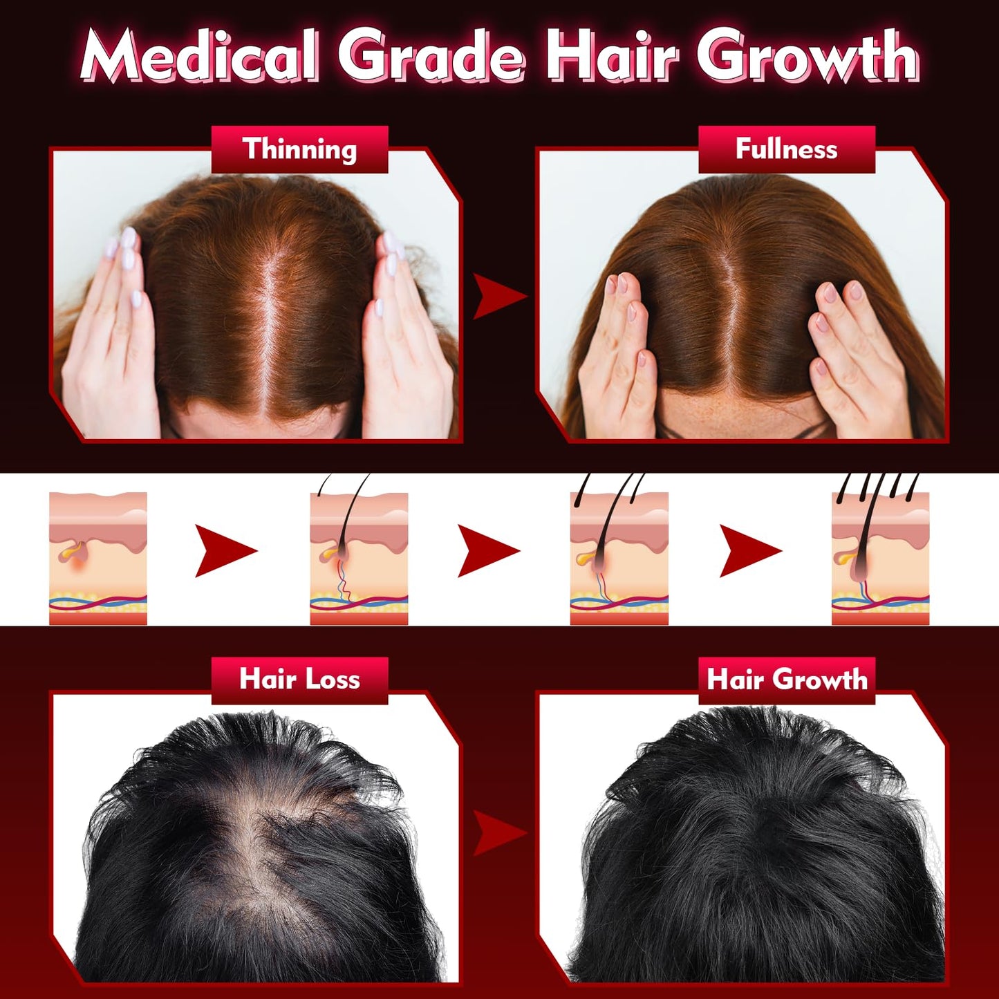 Hair Growth Device - FDA Cleared - UUPAS Professional Laser Diodes Red Light Therapy Hair Growth Cap System for Hair Regrowth, Alopecia - Hair Growth Treatments Products for Men Women - Medaid International