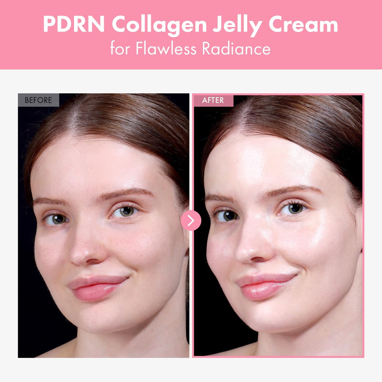 TOSOWOONG PDRN Collagen Jelly Cream, 5,000ppm Salmon DNA PDRN, Niacinamide, Hydrolyzed Collagen, Glow, Hydrating, Firming, Uneven Skin Tone, No artificial color, Korean Skin Care, 50ml, 1.69 fl.oz. - Medaid International