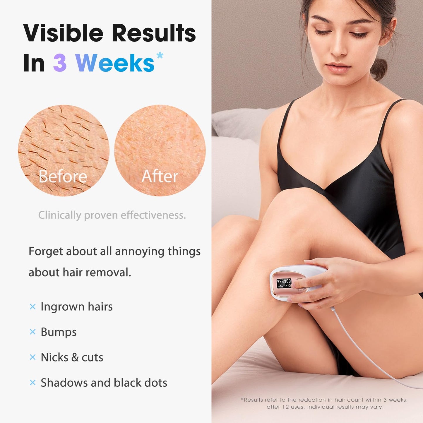 Oreeth IPL Laser Hair Removal Device for Women & Men - Home 45°F Ice-Cooling Contact for Painless & Long-Lasting Results, 86% Hair Reduction in 3 Weeks for Full Body & Bikini Line, Rose Gold - Medaid International