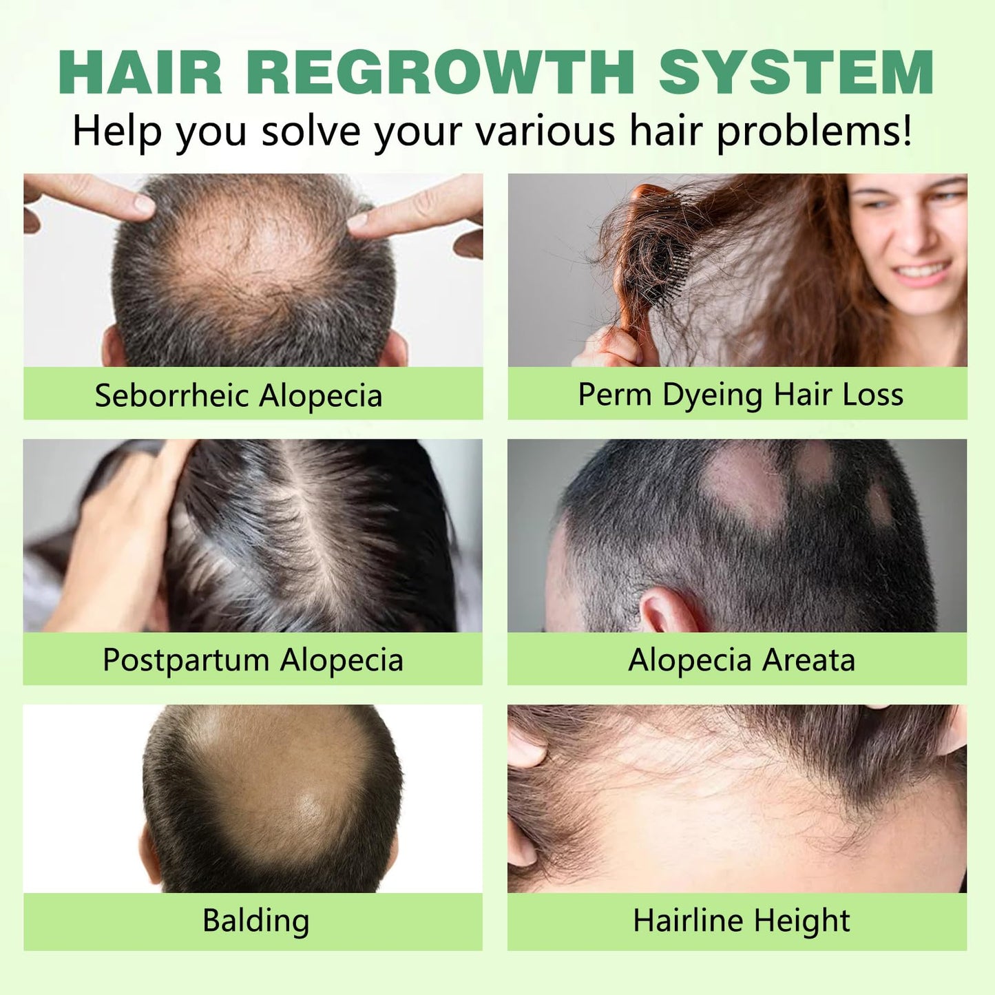 Hair Regrowth System, Advanced Hair Growth Treatment Ginseng, Eclipta Prostrata,Peppermint Oil & Ginger Root,Strengthens Hair Roots,Thickening Serum for Men & Women (1 Set) - Medaid International