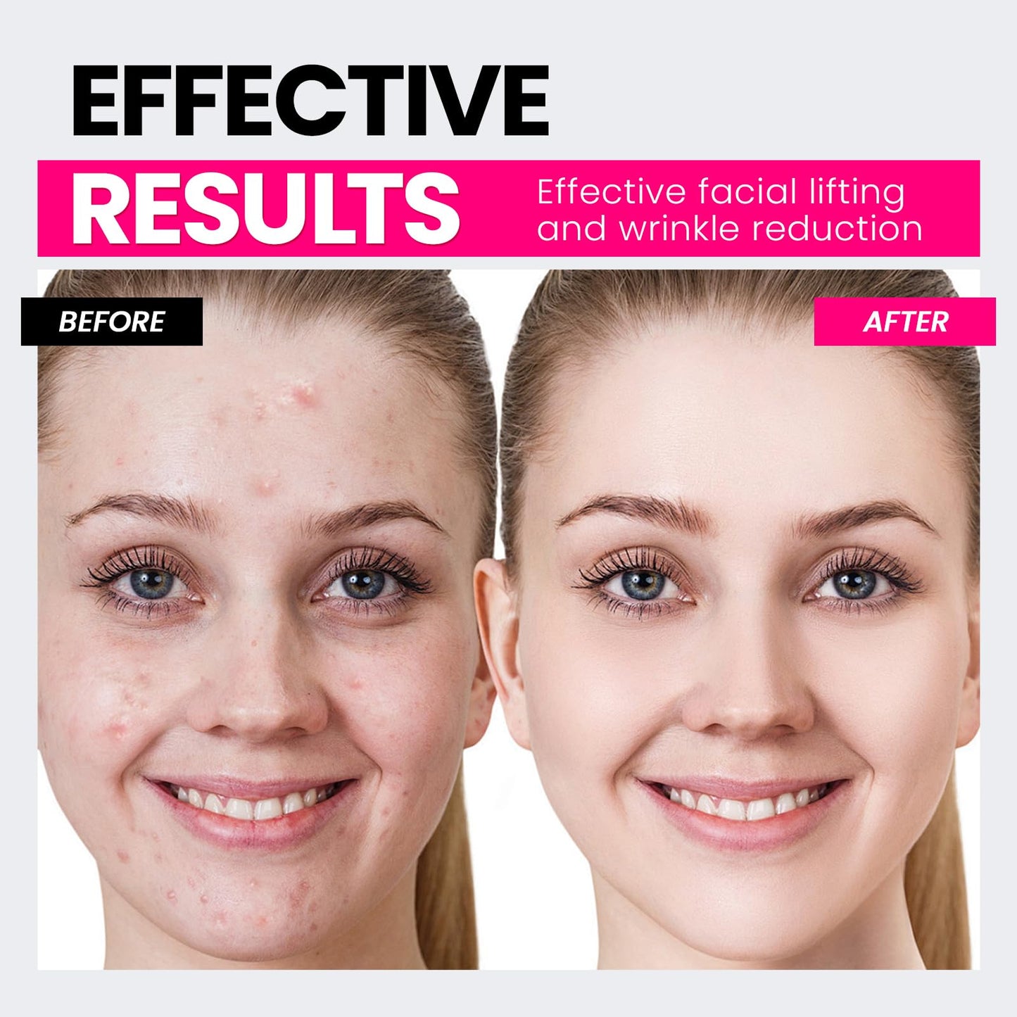 Hunvva Microcurrent Facial Device,Latest Red Light Technology,Enhances The Ability to Lift The Face and Tighten The Skin,Facial Wrinkle Equipment,Smart Photon Micro-Current Device,Model:EP-300. - Medaid International