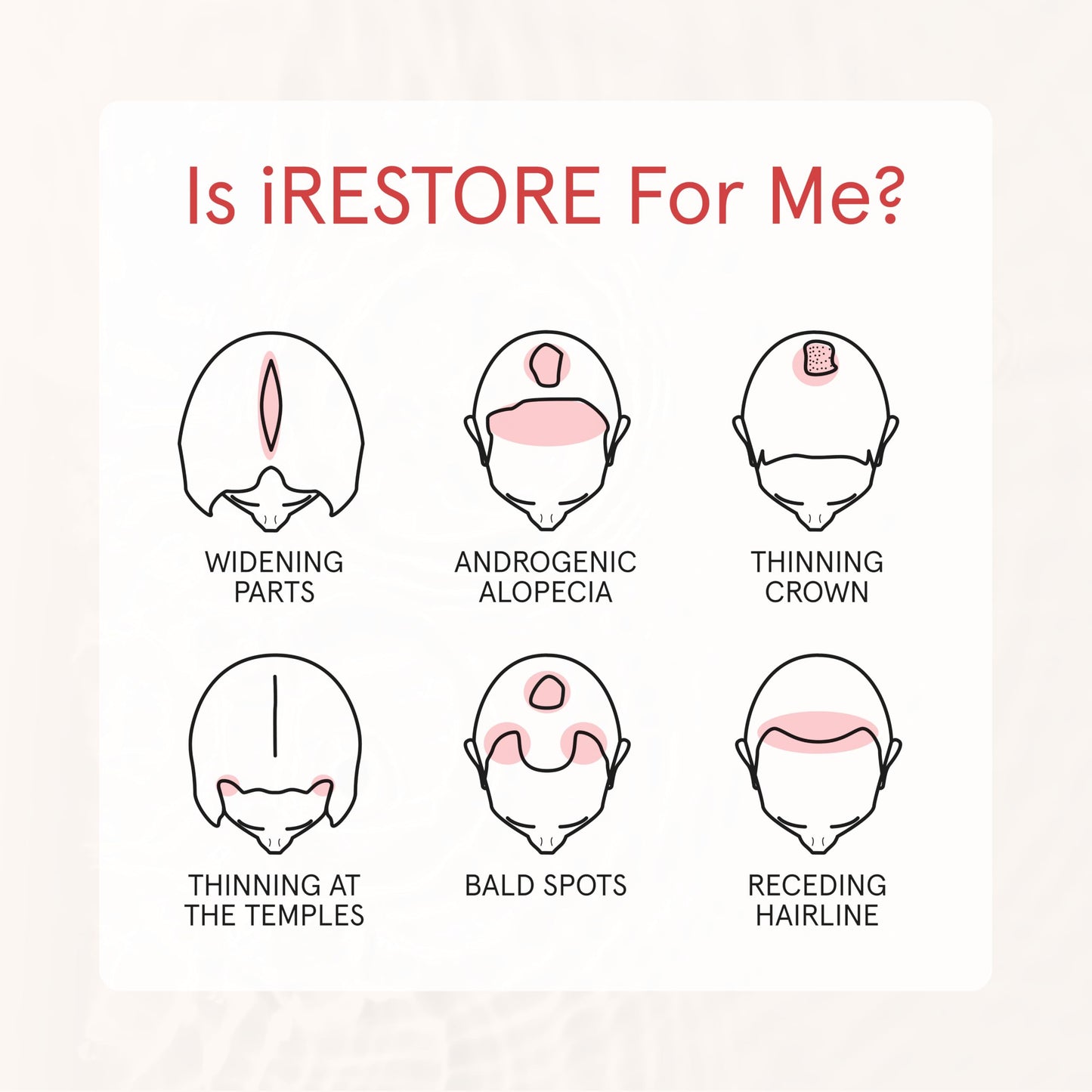 iRestore Anti Hair Loss and Thinning Shampoo - Biotin Formula for Hair Growth, Thickening and Volumizing for Men & Women - Medaid International